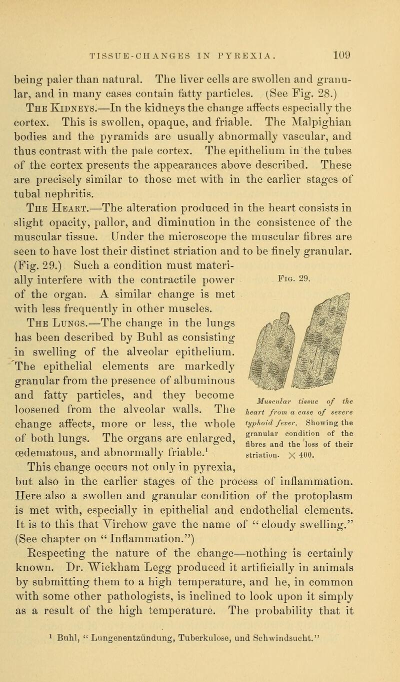 Fig. 29. being paler than natural. The liver cells are swollen and granu- lar, and in many cases contain fatty particles, (See Fig. 28.) The Kidneys.—In the kidneys the change affects especially the cortex. This is swollen, opaque, and friable. The Malpighian bodies and the pyramids are usually abnormally vascular, and thus contrast with the paie cortex. The epithelium in the tubes of the cortex presents the appearances above described. These are precisely similar to those met with in the earlier stages of tubal nephritis. The Heart.—The alteration produced in the heart consists in slight opacity, pallor, and diminution in the consistence of the muscular tissue. Under the microscope the muscular fibres are seen to have lost their distinct striation and to be finely granular. (Fig. 29.) Such a condition must materi- ally interfere with the contractile power of the organ. A similar change is met with less frequently in other muscles. The Lungs.—The change in the lungs has been described by Buhl as consisting in swelling of the alveolar epithelium. The epithelial elements are markedly granular from the presence of albuminous and fatty particles, and they become loosened from the alveolar walls. The change affects, more or less, the whole of both lungs. The organs are enlarged, cedematous, and abnormally friable.^ This change occurs not only in pyrexia, but also in the earlier stages of the process of inflammation. Here also a swollen and granular condition of the protoplasm is met with, especially in epithelial and endothelial elements. It is to this that Yirchow gave the name of  cloudy swelling. (See chapter on Inflammation.) Respecting the nature of the change—nothing is certainly known. Dr. Wickham Legg produced it artificially in animals by submitting them to a high temperature, and he, in common with some other pathologists, is inclined to look upon it simply as a result of the high temperature. The probability that it Muscular tissue of the heart from a case of severe tyi^hoid fever. Showing the granular condition of the fibres and the loss of their striation. X 400. Buhl,  Lungenentziindung, Tuberkulose, und Schwindsiicht.