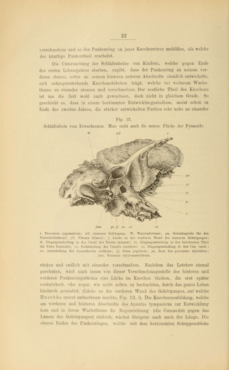 hmelzen und so den Paukenring zu jener Knochenrinne umbilden, als welche der künftige Paukentheil erscheint. Die Untersuchung der Schläfenbeine von Kindern, welche gegen Ende des ersten Lebensjahres starben, ergibt, dass der Paukenring an Beinern vor- deren oberen, sowie an seinem hinteren unteren Abschnitte ziemlich entwickelte, sieh entgegenstrebende Knochenstäbchen trägt, welche bei weiterem Wachs- thume an einander stossen und verschmelzen. Per restliehe Theil des Knochens ist um die Zeit wohl auch gewachsen, doch nicht in gleichem Grade. S geschieht es. dass in einem bestimmten Entwicklungsstadium, meist sehen zu Ende des /weiten Jahres, die stärker entwickelten Partien sehr nahe an einander Fig. 18. Schläfenbein vom Erwachsenen. Man sieht auch die untere Fläche der Pyramide. W aG /sin ~ iss i - gang; W, W&nentortsnri; fu, Gtalenksgrnhe t'ür den Unterkieferknopf; forderen Wand des tt. Eingangsmandnng in den l ngsnr&ndung iu den knöcherner «lei Taba Bnstochii; ... Endmnndung ingangsmhndnng in den Caa. earet : I ismftndoDg . tos Cochlea . ■- - ssos - . Poromen - .um. rücken und endlieh mit einander verschmelzen. Nachdem das !.• I tere einmal iahen, wird nach innen von dieser Verschmelzungsstelle des hinteren und vorderen Paukenringstückes eine Lücke im Knochen bleiben, die erst später verknöchert, >der BOgar, wie nicht selten zu beobachten, durch das ganze Leben hindurch persistirt. (Lücke an der vorderen Wand des Gehörganges, auf welche lUfmerksam machte. I }. Die Knochenneubildung-, welche am vorderen und hinteren Abschnitte des Annulns fcympanicuf twicklung kam und in ihrem Wachsthume Burichtung (di itäl gegen das Lumen d .h>t übrigens auch nach der Länge. Paukenrii . Iche mit dem horizontalen Schuppenstücke