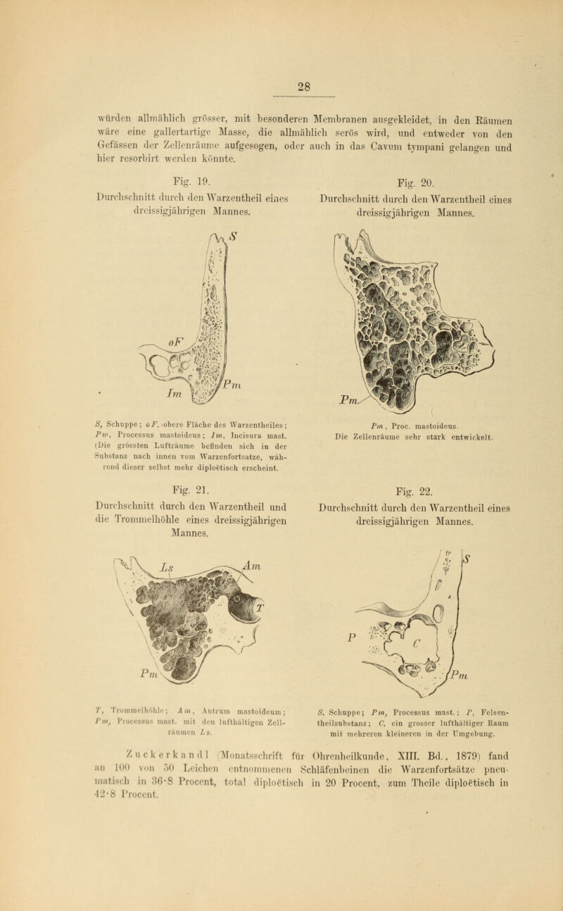 würden allmählich grösser, mit besonderen Membranen ausgekleidet, in den Räumen wäre eine gallertartige Masse, die allmählich serös wird, und entweder von den Gefässen der Zellenräume aufgesogen, oder auch in das Cavum tympani gelangen und hier resorbirt werden könnte. Fig. 19. Durchschnitt durch den Warzentheil eines dreissigjährigen Mannes. S, Schuppe; oF, obere Fläche des Warzentheiles; P»>, Processus mastoideus; Im, Incisura mast. (Die grössten Lufträume befinden sich in der Substanz nach innen vom Warzenfortsatze, wäh- rend dieser selbst mehr diploetisch erscheint. Fig. 21. Durchschnitt durch den Warzentheil und die Trommelhöhle eines dreissigjährigen Mannes. Fig. 20. Durchschnitt durch den Warzentheil eines dreissigjährigen Mannes. Pin , Proc. mastoideus. Die Zellenräume sehr stark entwickelt. Fig. 22. Durchschnitt durch den Warzentheil eines dreissigjährigen Mannes. '/', Trommelhöhle; Am, l'm, IV | mit räumen As. intrum inastoideum: len lufthaltigen Zell- S, Schuppe; Pm, Processus mast.; P, Felsen- theilsubstanz; C\ ein grosser lufthaltiger Raum mit mehreren kleineren in der Umgebung. Zuckerkand! Monatsschrift für Ohrenheilkunde, XiII. Bd., 1879) fand an LO0 von 50 Leichen entnommenen Schläfenbeinen die Warzenfortsätze pneu- matisch i .cent, total diplofitisch in 20 Procent, zum Theile diploetisch in Procent.