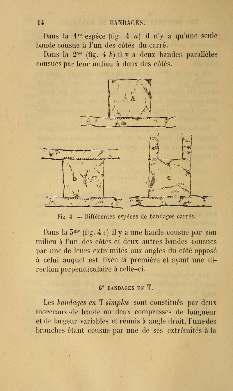 Dans la V^ espèce (fig. 4 a) il n'y a qu'une seule bande cousue à l'un des côtés du carré. Dans la 2^ (fig. 4 &) il y a deux bandes parallèles cousues par leur milieu à deux des côtés. Fig. 4. — Différentes espèces de bandages carrés. Dans la ô'-^ (fig. 4 c) il y a une bande cousue par son milieu à Tun des côtés et deux autres bandes cousues par une de leurs extrémités aux angles du côté opposé à celui auquel est fixée la première et ayant une di- rection perpendiculaire à celle-ci. 6° BANDAGES EN T. Les bandages en T simples sont constitués par deux morceaux-de bande ou deux compresses de longueur et de largeur variables et réunis à angle droit, l'une des branches étant cousue par une de ses extrémités à la