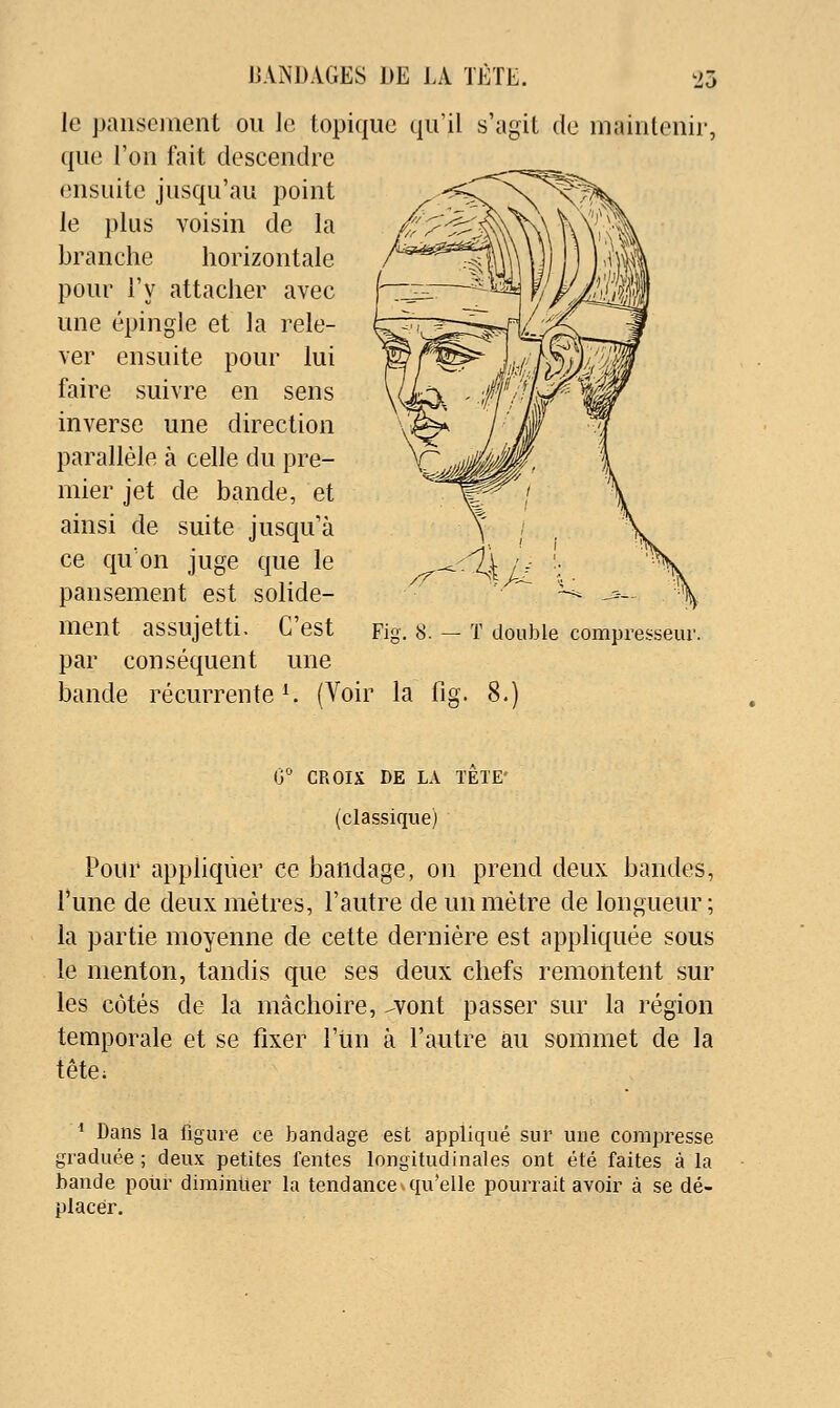 le pansement ou le topique qu'il s'agit de maintenir, que l'on fait descendre ensuite jusqu'au point le plus voisin de la branche horizontale pour l'y attacher avec une épingle et la rele- ver ensuite pour lui faire suivre en sens inverse une direction parallèle k celle du pre- mier jet de bande, et ainsi de suite jusqu'à ce qu'on juge que le pansement est solide- ment assujetti. C'est par conséquent une bande récurrente ^ (Voir la fig. 8.) Fig. 8. — T double compresseur. 0 CROIX DE LA TETE' (classique) Pour appliquer ce bandage, on prend deux bandes, l'une de deux mètres, l'autre de un mètre de longueur; la partie moyenne de cette dernière est appliquée sous le menton, tandis que ses deux chefs remontent sur les côtés de la mâchoire, ^vont passer sur la région temporale et se fixer l'un à l'autre au sommet de la tête; * Dans la figure ce bandage est appliqué sur une compresse graduée ; deux petites fentes longitudinales ont été faites à la bande pour diminuer la tendance v qu'elle pourrait avoir à se dé- placer.