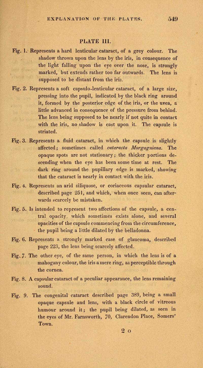 PLATE III. Fig. 1. Represents a hard lenticular cataract, of a grey colour. The shadow thrown upon the lens by the iris, in consequence of the light falling upon the eye over the nose, is strongly marked, but extends rather too far outwards. The lens is supposed to be distant from the iris. Fig. 2. Represents a soft capsulo-lenticular cataract, of a large size, pressing into the pupil, indicated by the black ring around it, formed by the posterior edge of the iris, or the uvea, a little advanced in consequence of the pressure from behind. The lens being supposed to be nearly if not quite in contact with the iris, no shadow is cast upon it. The capsule is striated. Fig. 3. Represents a fluid cataract, in which the capsule is slightly affected; sometimes called cataracta Morgagniana. The opaque spots are not stationary; the thicker portions de- scending when the eye has been some time at rest. The dark ring around the pupillary edge is marked, showing that the cataract is nearly in contact with the iris. Fig. 4. Represents an arid siliquose, or coriaceous capsular cataract, described page 251, and which, when once seen, can after- wards scarcely be mistaken. Fig. 5. Is intended to represent two affections of the capsule, a cen- tral opacity, which sometimes exists alone, and several opacities of the capsule commencing from the circumference, the pupil being a little dilated by the belladonna. Fig. 6. Represents a strongly marked case of glaucoma, described page 223, the lens being scarcely affected. Fig.. 7- The other eye, of the same person, in which the lens is of a mahogany colour, the iris a mere ring, as perceptible through the cornea. Fig. 8. A capsular cataract of a peculiar appearance, the lens remaining sound. Fig. 9. The congenital cataract described page 389, being a small opaque capsule and lens, with a black circle of vitreous humour around it; the pupil being dilated, as seen in the eyes of Mr. Farnsworth, 70, Clarendon Place, Somers' Town. 2 o