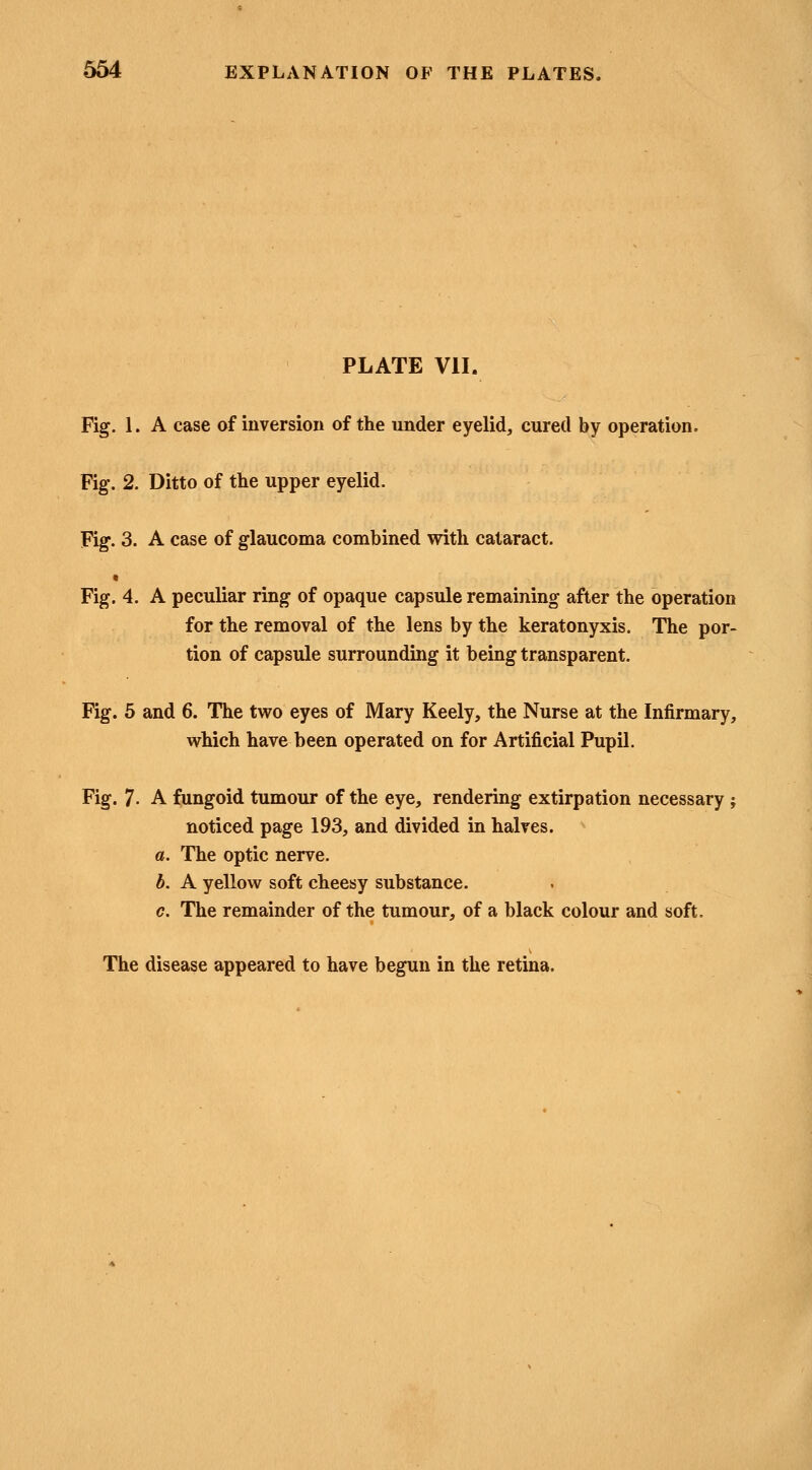 PLATE VII. Fig. 1. A case of inversion of the under eyelid, cured by operation. Fig. 2. Ditto of the upper eyelid. Fig. 3. A case of glaucoma combined with cataract. Fig. 4. A peculiar ring of opaque capsule remaining after the operation for the removal of the lens by the keratonyxis. The por- tion of capsule surrounding it being transparent. Fig. 5 and 6. The two eyes of Mary Keely, the Nurse at the Infirmary, which have been operated on for Artificial Pupil. Fig. 7- A fungoid tumour of the eye, rendering extirpation necessary ; noticed page 193, and divided in halves. a. The optic nerve. b. A yellow soft cheesy substance. c. The remainder of the tumour, of a black colour and soft. The disease appeared to have begun in the retina.