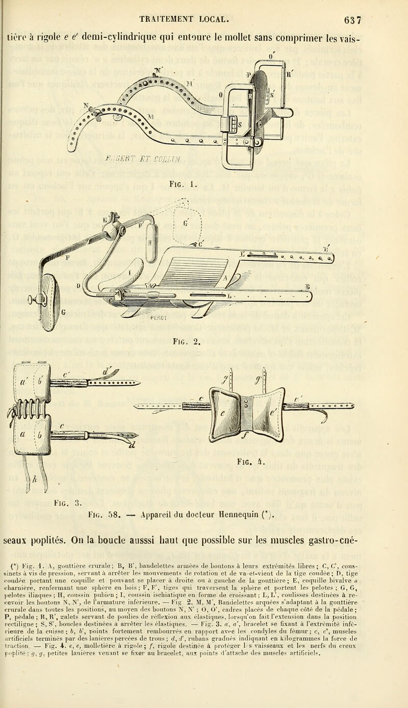 lière à rigole e e' demi-cylindrique qui entoure le mollet sans comprimer les vais- FlG. II. Fie. 3. Fig. 58. — Appareil du docteur Hennequin (¥). seaux poplités. On la boucle ausssi haut que possible sur les muscles gaslro-cné- (*) Fig. 1. A, gouttière crurale; B, B', bandelettes armées de boutons à leurs extrémités libres; C, C, cous- sinets à vis de pression, servant à arrêter les mouvements de rotation et de va-et-vient de la tige coudée ; I), tige coudée portant une coquille et pouvant se placer à droite on à gauche de la gouttière; E, coquille bivalve a charnière, renfermant une sphère en bois; F, F', tiges qui traversent la sphère et portent les pelotes; G, G, pelotes iliaques; H, coussin pubien; I, coussin ischiatique en forme de croissant; L,L', coulisses destinées à re- cevoir les boutons N, N', de l'armature inférieure. — Fig 2. M, M', Bandelettes arquées s'adaptant à la gouttière crurale dans toutes les positions, au moyen des boutons N, N' ; 0, O', cadres placés de chaque côté de la pédale ; P, pédale; B,R', calets servant de poulies de réllexion aux élastiques, lorsqu'on fait l'extension dans la position rectiligne ; S, S', boucles destinées à arrêter les élastiques. — Fig. 3. «, a', bracelet se fixant à l'extrémité infé- rieure de la cuisse; 6, 6', points fortement rembourrés en rapport avec les eondyles du fémur; c, e', muscles artificiels terminés par des lanières percées de trous ; d, d\ rubans gradués indiquant en kilogrammes la force de iraction. — Fig. 4. e,e, molletière à rigole; f, rigole destinée à protéger 1- s vaisseaux et les nerfs du creux poplité.; g, g. petites lanières venant se fixer au bracelet, aux points d'attache des muscle; artificiels.