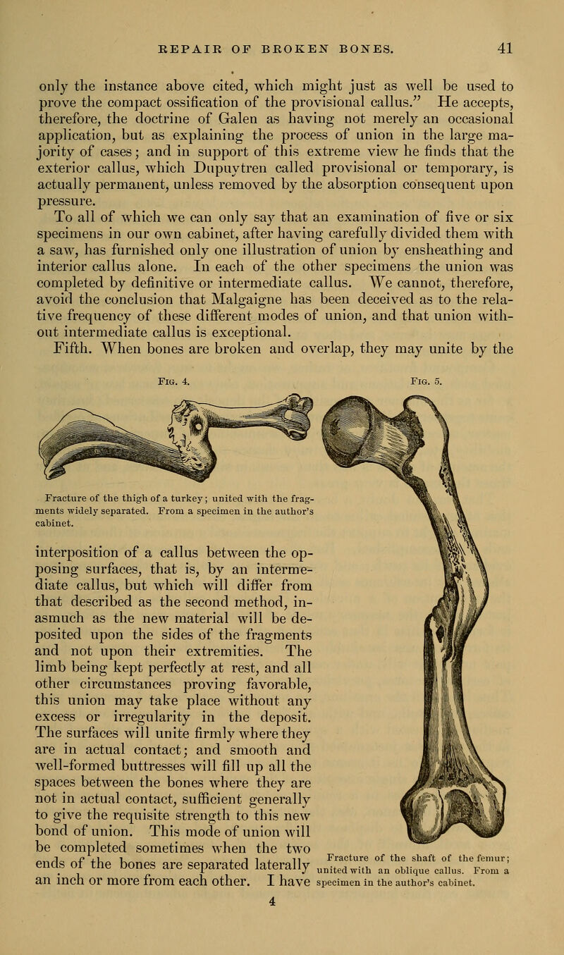 only the instance above cited, which might just as well be used to prove the compact ossification of the provisional callus/' He accepts, therefore, the doctrine of Galen as having not merely an occasional application, but as explaining the process of union in the large ma- jority of cases; and in support of this extreme view he finds that the exterior callus, which Dupuytren called provisional or temporary, is actually permanent, unless removed by the absorption consequent upon pressure. To all of which we can only say that an examination of five, or six specimens in our own cabinet, after having carefully divided them with a saw, has furnished only one illustration of union by ensheathing and interior callus alone. In each of the other specimens the union was completed by definitive or intermediate callus. We cannot, therefore, avoid the conclusion that Malgaigne has been deceived as to the rela- tive frequency of these different modes of union, and that union with- out intermediate callus is exceptional. Fifth. When bones are broken and overlap, they may unite by the Fig. 4. Fig. 5. Fracture of the thigh of a turkey; united with the frag- ments widely separated. From a specimen in the author's cabinet. interposition of a callus between the op- posing surfaces, that is, by an interme- diate callus, but which will differ from that described as the second method, in- asmuch as the new material will be de- posited upon the sides of the fragments and not upon their extremities. The limb being kept perfectly at rest, and all other circumstances proving favorable, this union may take place without any excess or irregularity in the deposit. The surfaces will unite firmly where they are in actual contact; and smooth and well-formed buttresses will fill up all the spaces between the bones where they are not in actual contact, sufficient generally to give the requisite strength to this new bond of union. This mode of union will be completed sometimes when the two ends of the bones are separated laterally an inch Or more from each Other. I have specimen in the author's cabinet. Fracture of the shaft of the femur; united with an oblique callus. From