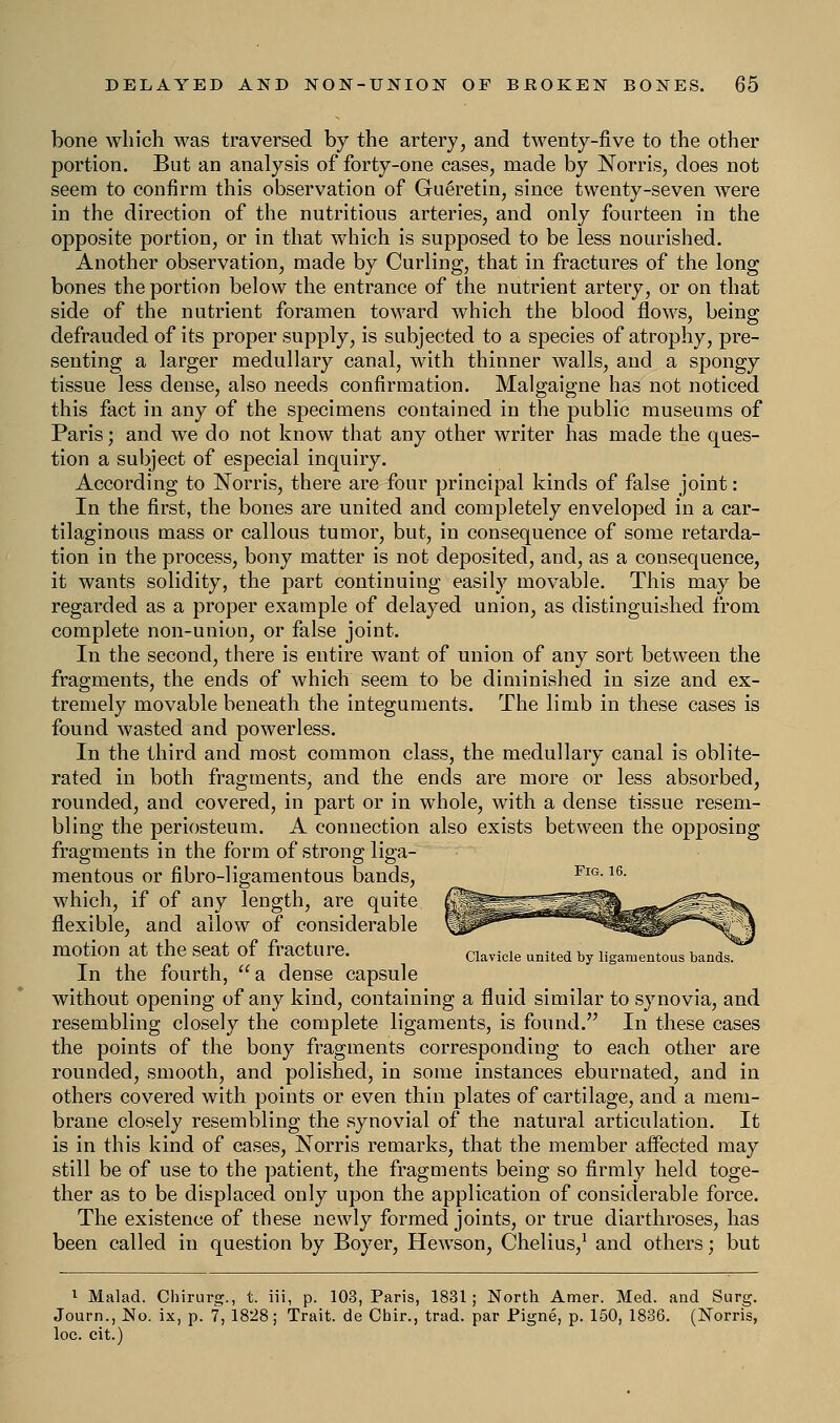 bone which was traversed by the artery, and twenty-five to the other portion. But an analysis of forty-one cases, made by Norris, does not seem to confirm this observation of Gu6retin, since twenty-seven were in the direction of the nutritious arteries, and only fourteen in the opposite portion, or in that which is supposed to be less nourished. Another observation, made by Curling, that in fractures of the long bones the portion below the entrance of the nutrient artery, or on that side of the nutrient foramen toward which the blood flows, being defrauded of its proper supply, is subjected to a species of atrophy, pre- senting a larger medullary canal, with thinner walls, and a spongy tissue less dense, also needs confirmation. Malgaigne has not noticed this fact in any of the specimens contained in the public museums of Paris; and we do not know that any other writer has made the ques- tion a subject of especial inquiry. According to Norris, there are four principal kinds of false joint: In the first, the bones are united and completely enveloped in a car- tilaginous mass or callous tumor, but, in consequence of some retarda- tion in the process, bony matter is not deposited, and, as a consequence, it wants solidity, the part continuing easily movable. This may be regarded as a proper example of delayed union, as distinguished from complete non-union, or false joint. In the second, there is entire want of union of any sort between the fragments, the ends of which seem to be diminished in size and ex- tremely movable beneath the integuments. The limb in these cases is found wasted and powerless. In the third and most common class, the medullary canal is oblite- rated in both fragments, and the ends are more or less absorbed, rounded, and covered, in part or in whole, with a dense tissue resem- bling the periosteum. A connection also exists between the opposing fragments in the form of strong liga- mentous or fibro-ligamentous bands, FlG-16- which, if of any length, are quite flexible, and allow of considerable motion at the Seat OI fracture. Clavicle united by ligamentous bands. In the fourth, a dense capsule without opening of any kind, containing a fluid similar to synovia, and resembling closely the complete ligaments, is found. In these cases the points of the bony fragments corresponding to each other are rounded, smooth, and polished, in some instances eburnated, and in others covered with points or even thin plates of cartilage, and a mem- brane closely resembling the synovial of the natural articulation. It is in this kind of cases, Norris remarks, that the member affected may still be of use to the patient, the fragments being so firmly held toge- ther as to be displaced only upon the application of considerable force. The existence of these newly formed joints, or true diarthroses, has been called in question by Boyer, Hewson, Chelius,1 and others; but 1 Malad. Chirurg., t. iii, p. 103, Paris, 1831; North Amer. Med. and Surg. Journ., No. ix, p. 7, 1828; Trait, de Chir., trad, par Pigne, p. 150, 1836. (Norris, loc. cit.)