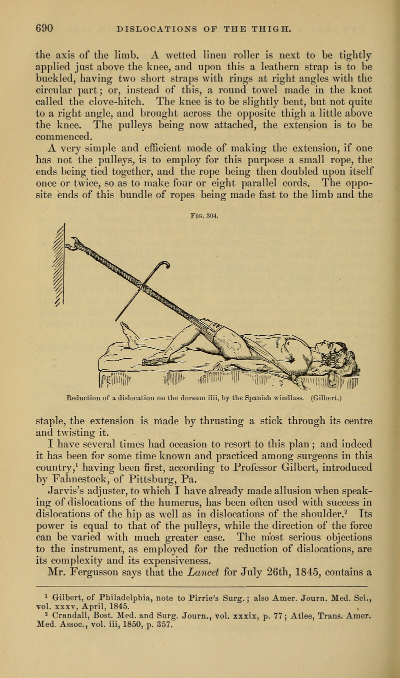 the axis of the limb. A wetted linen roller is next to be tightly- applied just above the knee, and upon this a leathern strap is to be buckled, having two short straps with rings at right angles with the circular part; or, instead of this, a round towel made in the knot called the clove-hitch. The knee is to be slightly bent, but not quite to a right angle, and brought across the opposite thigh a little above the knee. The pulleys being now attached, the extension is to be commenced. A very simple and efficient mode of making the extension, if one has not the pulleys, is to employ for this purpose a small rope, the ends being tied together, and the rope being then doubled upon itself once or twice, so as to make four or eight parallel cords. The oppo- site ends of this bundle of ropes being made fast to the limb and the Fig. 304. Seduction of a dislocation on the dorsum ilii, by the Spanish windlass. (Gilbert.) staple, the extension is made by thrusting a stick through its centre and twisting it. I have several times had occasion to resort to this plan; and indeed it has been for some time known and practiced among surgeons in this country,1 having been first, according to Professor Gilbert, introduced by Fahnestock, of Pittsburg, Pa. Jarvis's adjuster, to which I have already made allusion when speak- ing of dislocations of the humerus, has been often used with success in dislocations of the hip as well as in dislocations of the shoulder.2 Its power is equal to that of the pulleys, while the direction of the force can be varied with much greater ease. The most serious objections to the instrument, as employed for the reduction of dislocations, are its complexity and its expensiveness. Mr. Fergusson says that the Lancet for July 26th, 1845, contains a 1 Gilbert, of Philadelphia, note to Pirrie's Surg.; also Amer. Journ. Med. Sci., vol. xxxv, April, 1845. 2 Crandall, Bost. Med. and Surg. Journ., vol. xxxix, p. 77; Atlee, Trans. Amer. Med. Assoc, vol. iii, 1850, p. 357.