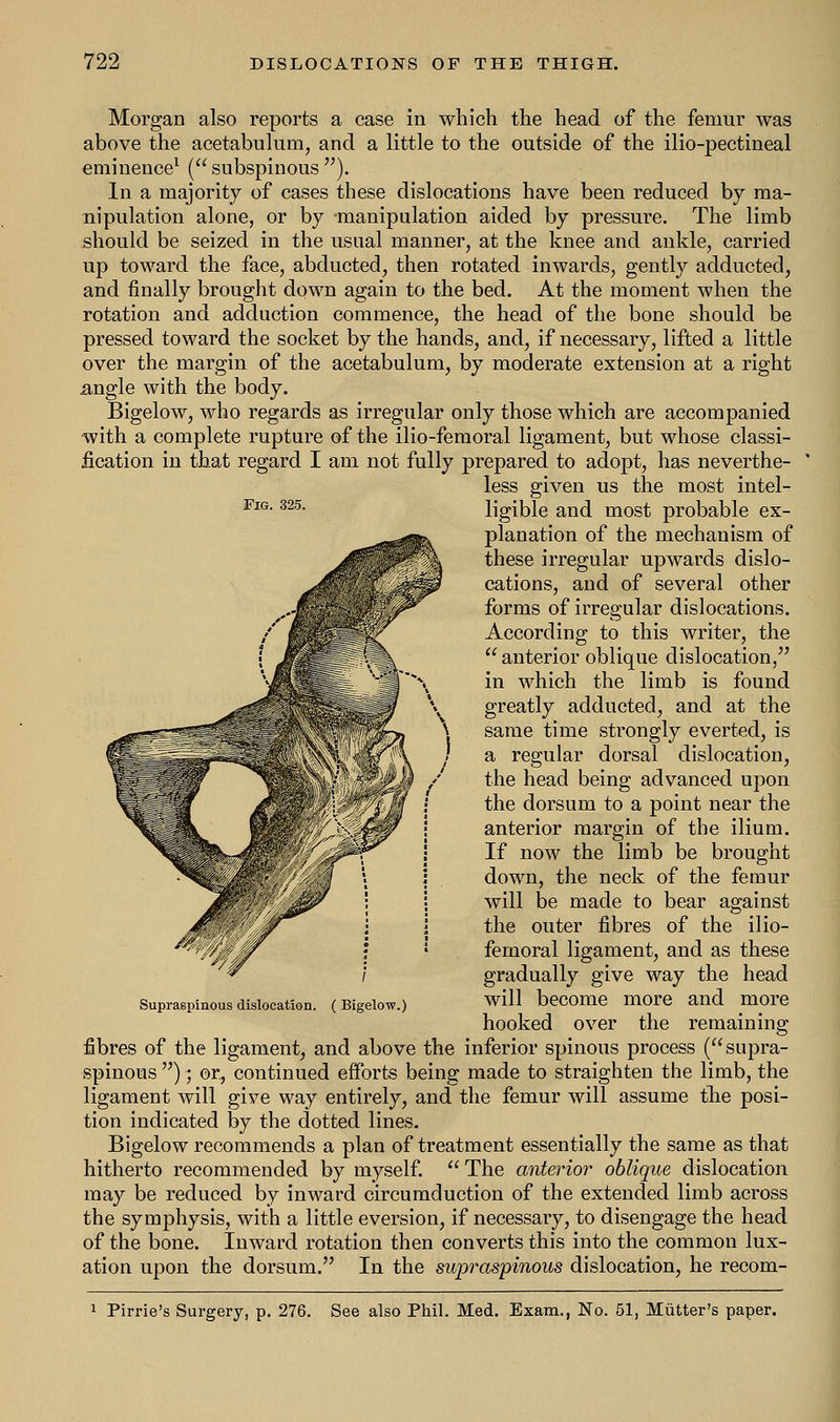 Fig. 325. Morgan also reports a case in which the head of the femur was above the acetabulum, and a little to the outside of the ilio-pectineal eminence1 ( subspinous ). In a majority of cases these dislocations have been reduced by ma- nipulation alone, or by -manipulation aided by pressure. The limb should be seized in the usual manner, at the knee and ankle, carried up toward the face, abducted, then rotated inwards, gently adducted, and finally brought down again to the bed. At the moment when the rotation and adduction commence, the head of the bone should be pressed toward the socket by the hands, and, if necessary, lifted a little over the margin of the acetabulum, by moderate extension at a right angle with the body. Bigelow, who regards as irregular only those which are accompanied with a complete rupture of the ilio-femoral ligament, but whose classi- fication in that regard I am not fully prepared to adopt, has neverthe- less given us the most intel- ligible and most probable ex- planation of the mechanism of these irregular upwards dislo- cations, and of several other forms of irregular dislocations. According to this writer, the  anterior oblique dislocation, in which the limb is found greatly adducted, and at the same time strongly everted, is a regular dorsal dislocation, the head being advanced upon the dorsum to a point near the anterior margin of the ilium. If now the limb be brought down, the neck of the femur will be made to bear against the outer fibres of the ilio- femoral ligament, and as these gradually give way the head will become more and more hooked over the remaining fibres of the ligament, and above the inferior spinous process (supra- spinous ); or, continued efforts being made to straighten the limb, the ligament will give way entirely, and the femur will assume the posi- tion indicated by the dotted lines. Bigelow recommends a plan of treatment essentially the same as that hitherto recommended by myself.  The anterior oblique dislocation may be reduced by inward circumduction of the extended limb across the symphysis, with a little eversion, if necessary, to disengage the head of the bone. Inward rotation then converts this into the common lux- ation upon the dorsum. In the supraspinous dislocation, he recom- Supraspinous dislocation. ( Bigelow.) 1 Pirrie's Surgery, p. 276. See also Phil. Med. Exam., No. 51, Mutter's paper.