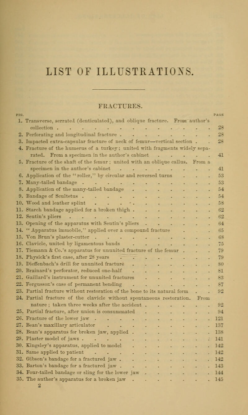 LIST OF ILLUSTRATIONS. FRACTURES. FIG. PASS 1. Tr —rratel ('denticulated), and oblique fracture. Frora author's collection ............. 28 2. Perforating and longitudinal fracture . . . . . . . . 2~ 3. Impacted extra-capsular fracture of neck of femur—vertical section . W 4. Fracture of the humerus of a turkey: united with fragments wi 1  - rated. From a specimen in the author's cabinet . .... 41 5. Fracture of the shaft of the femur ; united with an oblique callus. From a specimen in the author's cabinet ........ 41 6. Application of the roller. by circular and reversed turns . . . 53 7. Many-tailed bandage ........... 53 5. Application of the many-tailed bandage ....... 54 9. Bandage of Scultetus ........... 54 10. Wood and leather splint . . . - . . . . . . . 5S 11. Starch bandage applied for a broken thigh ....... 62 12. Seutin's pliers ............ 62 13. Opening of the apparatus with Seutin's pliers ....... 14.  Apparatus immobile. applied ov^r a compound fracture 65 15. Ton Bran's plaster-cutter .......... 68 16. Clavicle, united by ligamentous bands ....... 73 17. Tiemann k Co.s apparatus for ununited fracture of the femur . . .79 IS. Physick's first case, after 25 years 7'h 19. Dieffenbach's drill for ununited fracture . . . . . . 8( 20. Brainard's perforator, reduced one-half ....... 81 21. Gaillard:s instrument for ununited fractures ...... 83 22. Fergnsson's sase of permanent bending . . . . . . .87 23. Partial fracture without restoration of the bone to its natural form 24. Partial fracture of the clavicle without spontaneous restoration. Froni nature ; taken three weeks after the accident ...... 92 25. Partial fracture, after union is consummated ...... 94 26. Fracture of the lower jaw .......... 121 27. Bean's maxillary articulator ......... 137 28. Beans apparatus for broken jaw. applied ....... 138 29. Plaster model of jaws ........... 141 30. Kingsley's apparatus, applied to model ....... 142 31. Same applied to patient .......... 142 32. Gibson's bandage for a fractured jaw ........ 142 33. Barton's bandage for a fractured jaw . . . . . . . . 143 34. Four-tailed bandage or sling for the lower jaw ...... 144 35. The author's apparatus for a broken jaw ....... 145 2