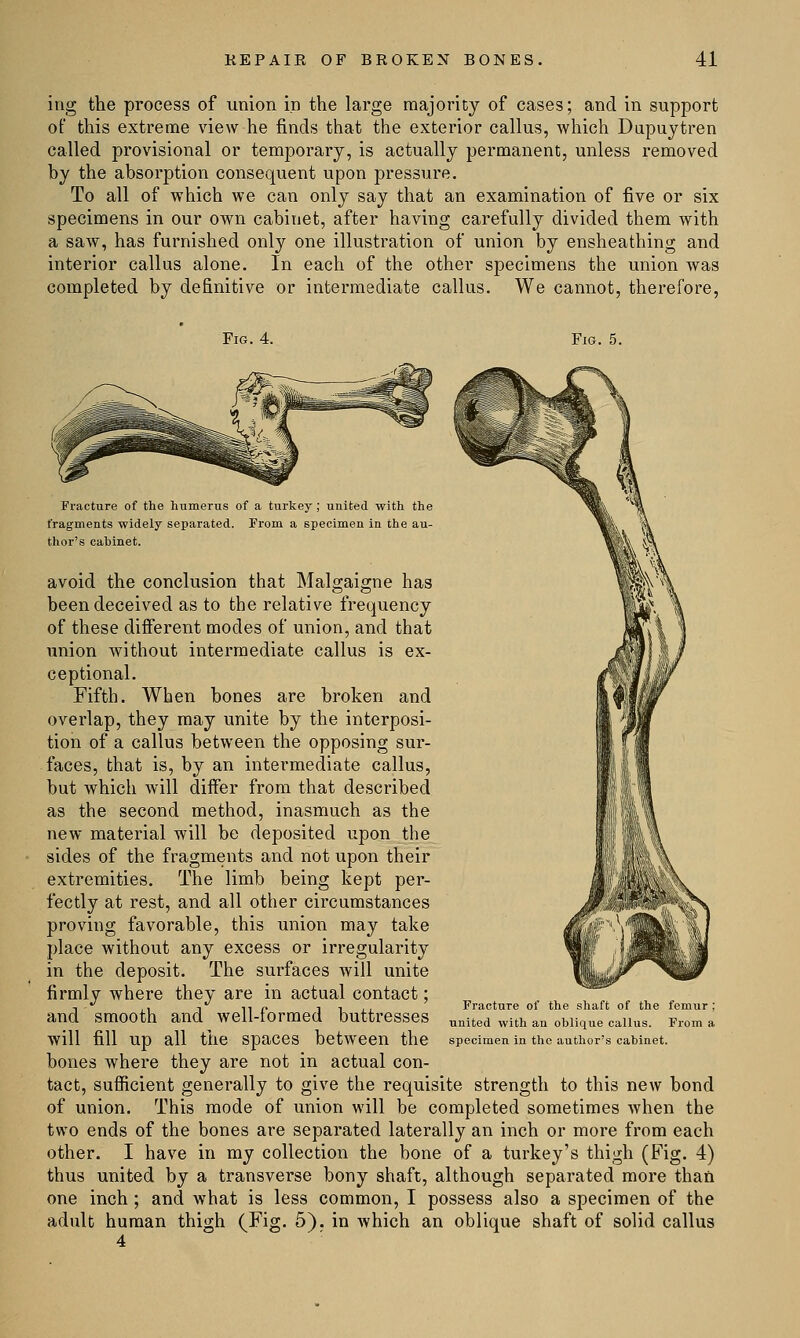 ing the process of union in the large majority of cases; and in support of this extreme view he finds that the exterior callus, which Dupuytren called provisional or temporary, is actually permanent, unless removed by the absorption consequent upon pressure. To all of which we can only say that an examination of five or six specimens in our own cabinet, after having carefully divided them with a saw, has furnished only one illustration of union by ensheathing and interior callus alone. In each of the other specimens the union was completed by definitive or intermediate callus. We cannot, therefore, Fig. 4. Fig. 5. Fracture of the humerus of a turkey ; united with the fragments widely separated. From a specimen in the au- thor's cahinet. avoid the conclusion that Malgaigne has been deceived as to the relative frequency of these different modes of union, and that union without intermediate callus is ex- ceptional. Fifth. When bones are broken and overlap, they may unite by the interposi- tion of a callus between the opposing sur- faces, that is, by an intermediate callus, but which will differ from that described as the second method, inasmuch as the new material will be deposited upon the sides of the fragments and not upon their extremities. The limb being kept per- fectly at rest, and all other circumstances proving favorable, this union may take place without any excess or irregularity in the deposit. The surfaces will unite firmly where they are in actual contact; and smooth and well-formed buttresses will fill up all the spaces between the bones where they are not in actual con- tact, sufficient generally to give the requisite strength to this new bond of union. This mode of union will be completed sometimes when the two ends of the bones are separated laterally an inch or more from each other. I have in my collection the bone of a turkey's thigh (Fig. 4) thus united by a transverse bony shaft, although separated more than one inch; and what is less common, I possess also a specimen of the adult human thigh (Fig. 5). in which an oblique shaft of solid callus 4 Fracture of the shaft of the femur : united with an oblique callus. From a specimen in the author's cabinet.