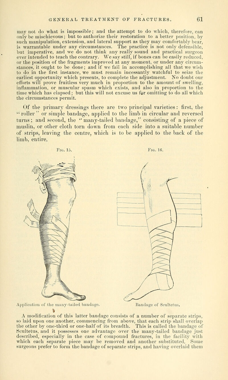 may not do what is impossible; and the attempt to do which, therefore, can only be mischievous; but to authorize their restoration to abetter position, by such manipulation, extension, and lateral support as they may comfortably bear, is warrantable under any circumstances. The practice is not only defensible, but imperative, and we do not think any really sound and practical surgeon ever intended to teach the contrary. We say still, if bones can be easily reduced, or the position of the fragments improved at any moment, or under any circum- stances, it ought to be done; and if we fail in accomplishing all tbat we wish to do in the first instance, we must remain incessantly watchful to seize the earliest opportunity which presents, to complete the adjustment. No doubt our efforts will prove fruitless very much in proportion to the amount of swelling, inflammation, or muscular spasm which exists, and also in proportion to the time which has elapsed; but this will not excuse us for omitting to do all which the circumstances permit. Of the primary dressings there are two principal varieties: first, the  roller  or simple bandage, applied to the limb in circular and reversed turns; and second, the  many-tailed bandage, consisting of a piece of muslin, or other cloth torn down from each side into a suitable number of strips, leaving the centre, which is to be applied to the back of the limb, entire. Fm. 15. Fig. 16. Ajjplication of the many-tailed bandage. Bandage of Scultetus. A modification of this latter bandage consists of a number of separate strips, so laid upon one another, commencing from above, that each strip shall overlap the other by one-third or one-half of its breadth. This is called the bandage of Scultetus, and it possesses one advantage over the many-tailed bandage just described, especially in the case of compound fractures, in the facility with which each separate piece may be removed and another substituted. Some surgeons prefer to form the bandage of separate strips, and having overlaid them