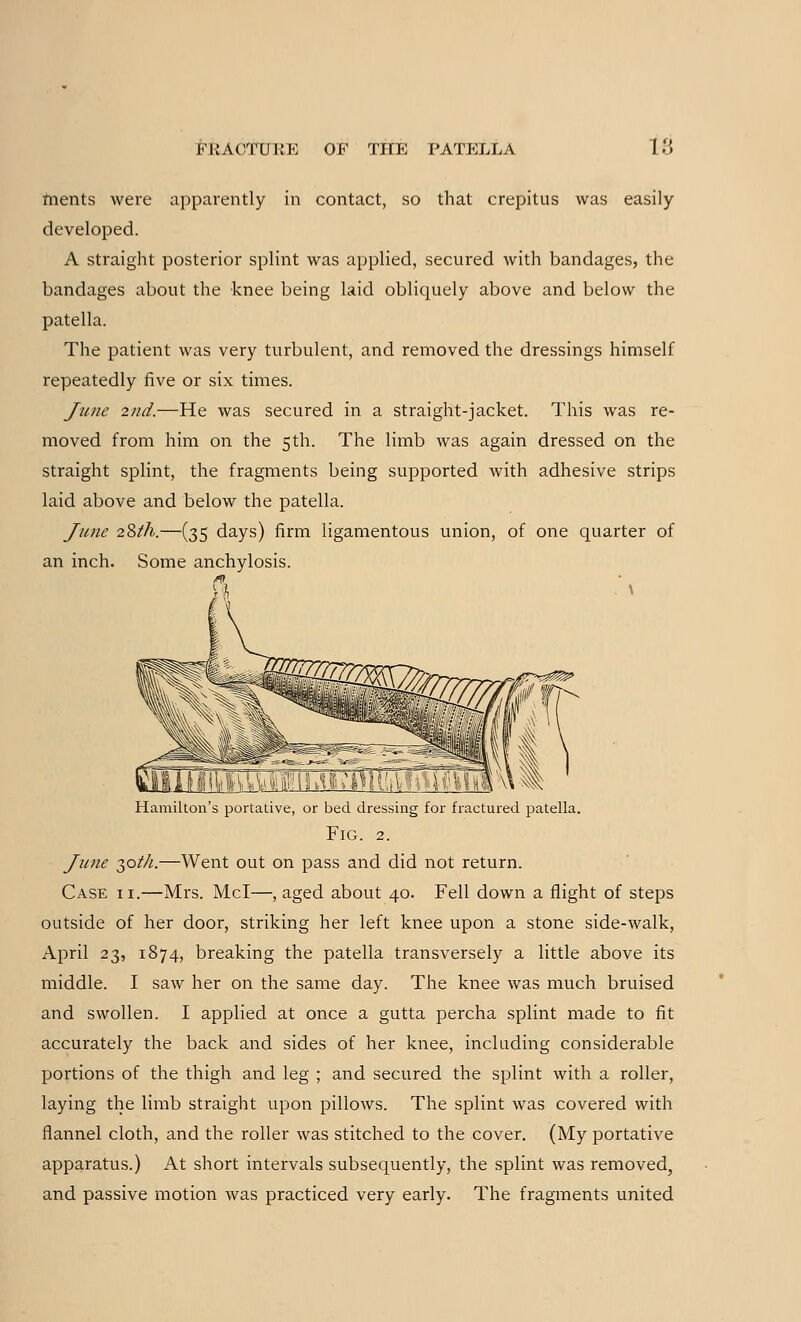 fnents were apparently in contact, so that crepitus was easily developed. A straight posterior splint was applied, secured with bandages, the bandages about the knee being laid obliquely above and below the patella. The patient was very turbulent, and removed the dressings himself repeatedly five or six times. June 2nd.—He was secured in a straight-jacket. This was re- moved from him on the 5th. The limb was again dressed on the straight splint, the fragments being supported with adhesive strips laid above and below the patella. June 28th.—(35 days) firm ligamentous union, of one quarter of an inch. Some anchylosis. Hamilton's portative, or bed dressing for fractured patella. Fig. 2. June T,oth.—Went out on pass and did not return. Case ii.—Mrs. Mel—, aged about 40. Fell down a flight of steps outside of her door, striking her left knee upon a stone side-walk, April 23, 1874, breaking the patella transversely a little above its middle. I saw her on the same day. The knee was much bruised and swollen. I applied at once a gutta percha splint made to fit accurately the back and sides of her knee, including considerable portions of the thigh and leg ; and secured the splint with a roller, laying the limb straight upon pillows. The splint was covered with flannel cloth, and the roller was stitched to the cover. (My portative apparatus.) At short intervals subsequently, the splint was removed, and passive motion was practiced very early. The fragments united