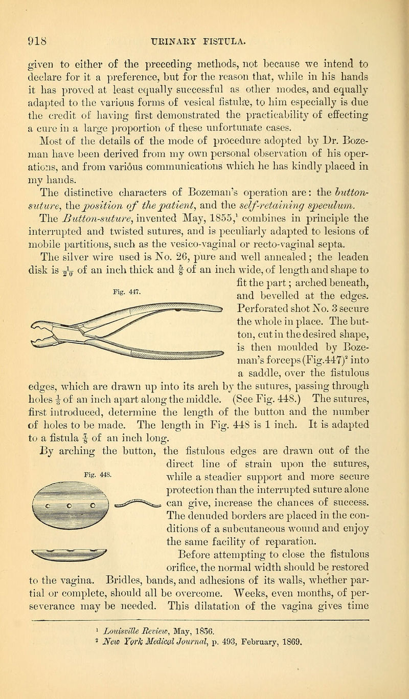 Pig. 447. given to either of the preceding methods, not because -we intend to declare for it a preference, but for the reason that, while in his hands it has proved at least equally successful as other modes, and equally adapted to the various forms of vesical fistulse, to him especially is due the credit of having first demonstrated the practicability of effecting a cure in a large proportion of these unfortunate cases. Most of the details of the mode of procedure adopted by Dr. Boze- man have been derived from my own personal observation of his oper- ations, and from various communications which he has kindly placed in my hands. The distinctive characters of Bozeman's operation are: the button- suture, the position of the patient, and the self-retaining speculum. The Button-suture, invented May, 1855,1 combines in principle the interrupted and twisted sutures, and is peculiarly adapted to lesions of mobile partitions, such as the vesico-vaginal or recto-vaginal septa. The silver wire used is No. 26, pure and wTell annealed; the leaden disk is -£-§ of an inch thick and -f of an inch wide, of length and shape to fit the part; arched beneath, and bevelled at the edges. Perforated shot No. 3 secure the whole in place. The but- ton, cut in the desired shape, is then moulded by Boze- man's forceps (Fig.447)2 into a saddle, over the fistulous edges, which are drawn up into its arch by the sutures, passing through holes \ of an inch apart along the middle. (See Fig. 448.) The sutures, first introduced, determine the length of the button and the number of holes to be made. The length in Fig. 448 is 1 inch. It is adapted to a fistula -§ of an inch long. By arching the button, the fistulous edges are drawn out of the direct line of strain upon the sutures, while a steadier support and more secure protection than the interrupted suture alone can give, increase the chances of success. The denuded borders are placed in the con- ditions of a subcutaneous wound and enjoy the same facility of reparation. Before attempting to close the fistulous orifice, the normal width should be restored to the vagina. Bridles, bands, and adhesions of its walls, whether par- tial or complete, should all be overcome. Weeks, even months, of per- severance may be needed. This dilatation of the vagina gives time Fig. 448. 1 Louisville Review, May, 1856. 2 New York Medical Journal, p. 493, February, 1869.