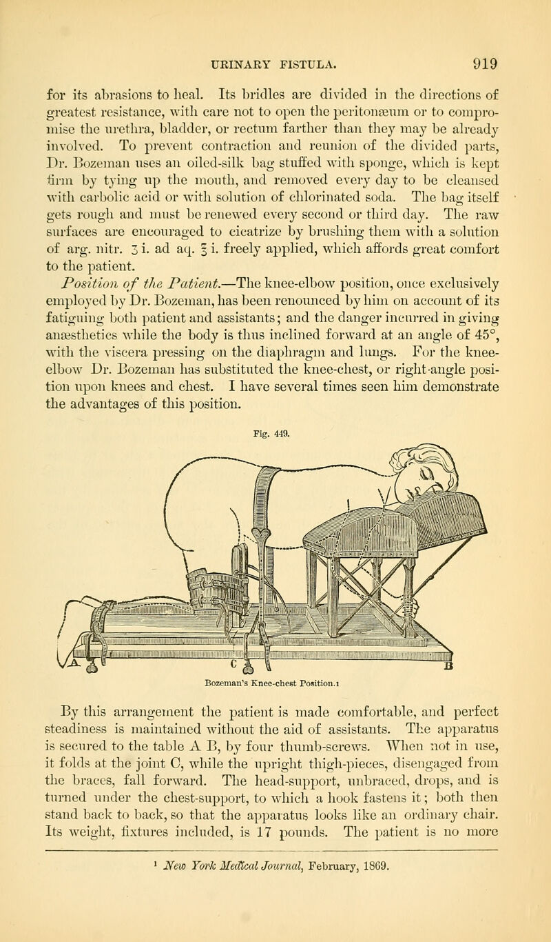 for its abrasions to heal. Its bridles are divided in the directions of greatest resistance, with care not to open the peritonaeum or to compro- mise the urethra, bladder, or rectum farther than they may be already involved. To prevent contraction and reunion of the divided parts, Dr. Bozeman uses an oiled-silk bag stuffed with sponge, which is kept firm by tying up the mouth, and removed every day to be cleansed with carbolic acid or with solution of chlorinated soda. The bag itself gets rough and must be renewed every second or third day. The raw surfaces are encouraged to cicatrize by brushing them with a solution of arg. nitr. 3 i. ad aq. 3 i. freely applied, which affords great comfort to the patient. Position of the Patient.—The knee-elbow position, once exclusively employed by Dr. Bozeman, has been renounced by him on account of its fatiguing both patient and assistants; and the danger incurred in giving anaesthetics while the body is thus inclined forward at an angle of 45°, with the viscera pressing on the diaphragm and lungs. For the knee- elbow Dr. Bozeman has substituted the knee-chest, or right-angle posi- tion upon knees and chest. I have several times seen him demonstrate the advantages of this position. Fig. 449. Bozeman's Knee-chest Position. 1 By this arrangement the patient is made comfortable, and perfect steadiness is maintained without the aid of assistants. The apparatus is secured to the table A B, by four thumb-screws. When not in use, it folds at the joint C, while the upright thigh-pieces, disengaged from the braces, fall forward. The head-support, unbraced, drops, and is turned under the chest-support, to which a hook fastens it; both then stand back to back, so that the apparatus looks like an ordinary chair. Its weight, fixtures included, is 17 pounds. The patient is no more