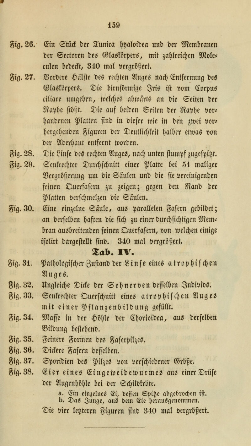 gig. 26/ ©in ©tiid ber Zunka Ijtjafoibea unb ber Membranen ber ©ectoren beS ©lasfßr^ers, mit jafylreicfjen 3Me* culen bebecft, 340 mal vergrößert. gig. 27. 23orbere Hälfte beS rechten 2IugeS ttarf) (Entfernung beS ©la^fBrper^* 2)te birnförmige SriS ifl Dom SorpuS ciliare umgeben, n>eld)eS abtoarts an bie <£tikn ber 9?ap&e ftöfjt. £ie auf betben Seiten ber 9t<ty$e vor* banbenen platten ftnb in biefer tote in ben jtoet vor* fyergefjenben giguren ber £)eutlid)feit falber etoas von ber Stoertyaut entfernt korben. gig. 28. Sic Sinfe beS rechten SlugeS, nad) unten jlumpf jugefyi^t. gig. 29* «Senfvecfyter Durc^fd&nitt einer platte M 51 maliger SBergrBpcrung um bie ©aulen unb bie fte vereinigenben feinen Duerfafern ju geigen; gegen ben $?anb ber platten verfcfymeljen bie ©aulen. gig. 30. @ne einzelne ©aule, aus parallelen gafern gebilbet; an berfelben haften bie ftd) ju einer burtfyftcfyttgen 9Wem* bran ausbreitenben feinen Duerfafern, von n>eld^en einige ifolirt bargefteflt ftnb. 340 mat vergrößert. $afr. IV. gig. 31. ^at()olcgifd)erBuftanb ber Stufe eines atro^if^en 9IugeS. gig. 32. Ungleiche 2)icfe ber @efy nerven beffelben SnbivibS. gig. 33. ©enfrecfyter Öuerfcfynitt eines airopf)ifcI)en9IugeS mit einer $flanjenbilbung gefüllt. gig. 34. Sftaffe in ber £i}f)le ber Sfyorioibea, aus berfelben Silbung beßebenb. gig. 35. geinere gönnen bes gaferpifjeS. gig. 36. Stcfere gafem beffelben. gig. 37. ©poribien beS $iljeS von verriebener ®röße. gig* 38. Ster eines ©ingetoeibetvurmeS aus einer ©rufe ber 31ugenbi}()le bei ber ©cfcitofröte. a. (Süt einzelnes di, beffen ©pt£e abgebrochen tfh b. 2)aS 3«nge, aus kern Qne herausgenommen* Sie vier testeten giguren ftnb 340 mal vergrößert.