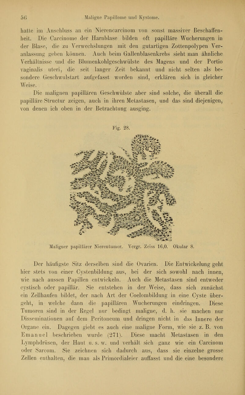 hatte im Anschluss an ein Nieren carcinom von sonst massiver Beschaffen- heit. Die Oareinome der Harnblase bilden oft papilläre Wucherungen in der Blase, die zu Verwechslungen mit den gutartigen Zottenpolypen Ver- anlassung geben können. Auch beim Gallenblasenkrebs sieht man ähnliche Verhältnisse und die Blumenkohlgesehwülste des Magens und der Portio vaginalis uteri, die seit langer Zeit bekannt und nicht selten als be- sondere Geschwulstart aufgefasst worden sind, erklären sich in gleicher Weise. Die malignen papillären Geschwülste aber sind solche, die überall die papilläre Structur zeigen, auch in ihren Metastasen, und das sind diejenigen, von denen ich oben in der Betrachtung ausging. Fig. 28. i */J£ -2?«* ■■> sS'msj. ^ S> -W 'S? .. Maligner papillärer Nierentumor. Vergr. Zeiss 16,0. Okular 8 Der häufigste Sitz derselben sind die Ovarien. Die Entwicklung geht hier stets von einer Cystenbildung aus, bei der sich sowohl nach innen, wie nach aussen Papillen entwickeln. Auch die Metastasen sind entweder cystisch oder papillär. Sie entstehen in der Weise, dass sich zunächst ein Zellhaufen bildet, der nach Art der Coelombildung in eine Cyste über- geht, in welche dann die papillären Wucherungen eindringen. Diese Tumoren sind in der Regel nur bedingt maligne, d. h. sie machen nur Disseminationen auf dem Peritoneum und dringen nicht in das Innere der Organe ein. Dagegen giebt es auch eine maligne Form, wie sie z. B. von Emanuel beschrieben wurde (271). Diese macht Metastasen in den Lymphdrüsen, der Haut u. s. w. und verhält sich ganz wie ein Carcinom oder Sarcom. Sie zeichnen sich dadurch aus, dass sie einzelne grosse Zellen enthalten, die man als Primordialeier auffasst und die eine besondere