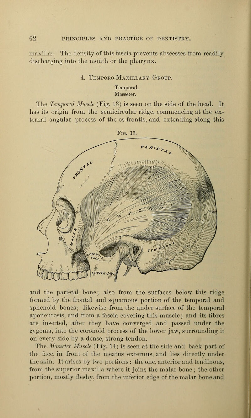 maxillae. The density of this fascia prevents abscesses from readily discharging into the mouth or the pharynx. 4. Temporo-Maxillary Group. Temporal. Masseter. The Temporal Muscle (Fig. 13) is seen on the side of the head. It has its origin from the semicircular ridge, commencing at the ex- ternal angular process of the os-frontis, and extending along this Fig. 13. and the parietal bone; also from the surfaces below this ridge formed by the frontal and squamous portion of the temporal and sphenoid bones; likewise from the under surface of the temporal aponeurosis, and from a fascia covering this muscle; and its fibres are inserted, after they have converged and passed under the zygoma, into the coronoid process of the lower jaw, surrounding it on every side by a dense, strong tendon. The Masseter Muscle (Fig. 14) is seen at the side and back part of the face, in front of the meatus externus, and lies directly under the skin. It arises by two portions: the one, anterior and tendinous, from the superior maxilla where it joins the malar bone; the other portion, mostly fleshy, from the inferior edge of the malar bone and