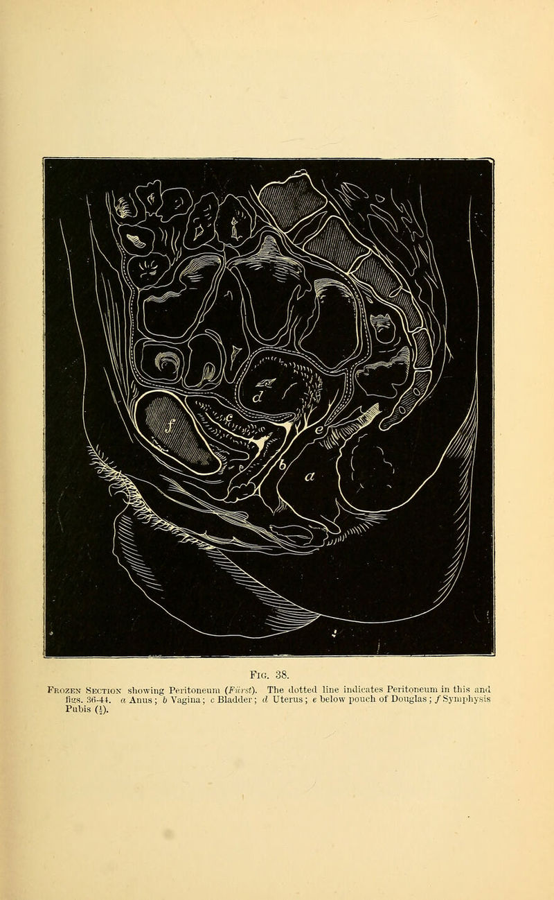 Frozen Section showing Peritoneum (F-iirst). The dotted line indicates Peritoneum in this and fisjs. 3fi-44. a Anus; 6 Vagina; c Bladder; d Uterus; e below pouch of Douglas ; /Symphysis Pubis (i).