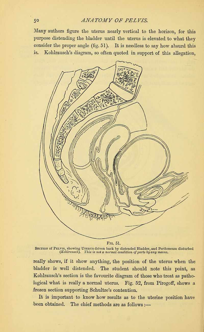 Many authors figure the uterus nearly vertical to the horizon, for this purpose distending the bladder until the uterus is elevated to what they consider the proper angle (fig. 51). It is needless to say how absurd this is. Kohlrausch's diagram, so often quoted in support of this allegation, Fig. 51. Section of Pelvis, showing Uterus driven back by distended Bladder, and Peritoneum disturbed (Kohlrausch). This is not a normal condition of parts by any means. really shows, if it show anything, the position of the uterus when the bladder is well distended. The student should note this point, as Kohlrausch's section is the favourite diagram of those who treat as patho- logical what is really a normal uterus. Fig. 52, from Pirogoff, shows a frozen section supporting Schultze's contention. It is important to know how results as to the uterine position have been obtained. The chief methods are as follows:—