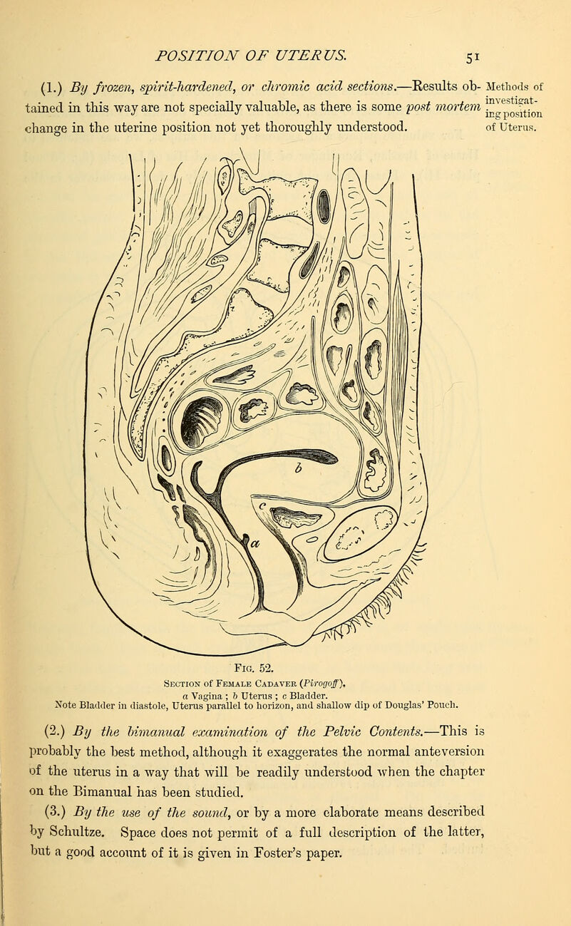 (1.) By frozen, spirit-hardened, or chromic acid sections.—Results ob- Methods of tained in this way are not specially valuable, as there is some post mortem ™ve* ^fj change in the uterine position not yet thoroughly understood. of Uterus. Fig. 52. Section of Female Cadaver (Pi a Vagina ; b Uterus ; c Bladder. Note Bladder in diastole, Uterus parallel to horizon, and shallow dip of Douglas' Pouch. (2.) By the bimanual examination of the Pelvic Contents.—This is probably the best method, although it exaggerates the normal anteversion of the uterus in a way that will be readily understood when the chapter on the Bimanual has been studied. (3.) By the use of the sound, or by a more elaborate means described by Schultze. Space does not permit of a full description of the latter, but a good account of it is given in Foster's paper.