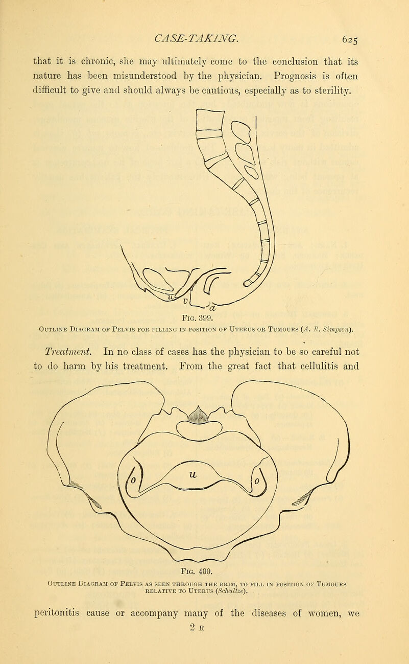 that it is chronic, she may ultimately come to the conclusion that its nature has been misunderstood by the physician. Prognosis is often difficult to give and should always be cautious, especially as to sterility. 'a, Fig. 399. Outline Diagram of Pelvis foe filling in position of Uterus or Tumours (A. B. Simpson). Treatment. In no class of cases has the physician to be so careful not to do harm by his treatment. From the great fact that cellulitis and Fig. 400. Outline Diagram of Pelvis as seen through the brim, to fill in position o Tumours RELATIVE TO UTERUS (Schultzc). peritonitis cause or accompany many of the diseases of women, we 2 R