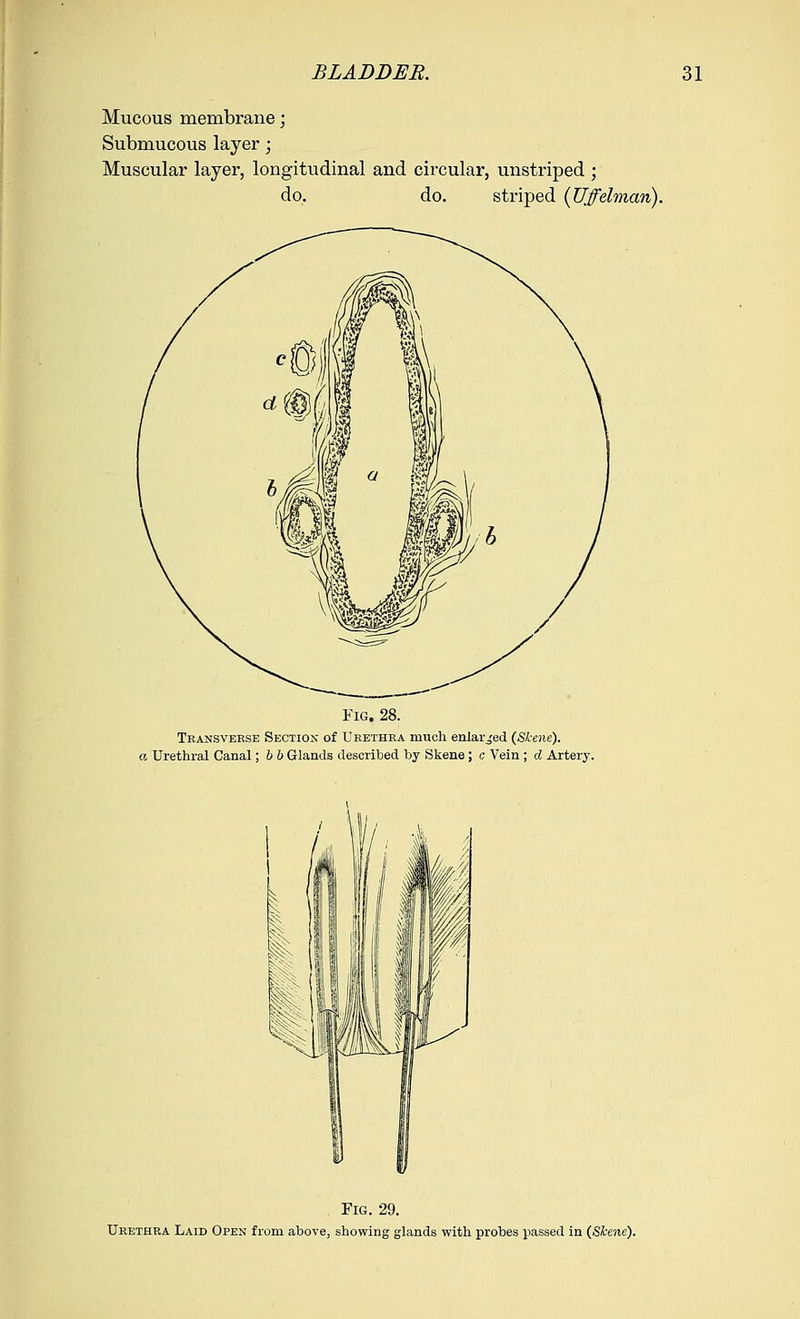 Mucous membrane; Submucous layer; Muscular layer, longitudinal and circular, unstriped ; do. do. striped (Uffelman). Fig. 28. Transverse Section of Urethra much enlarged {Skene}, a Urethral Canal; b b Glands described by Skene; c Vein ; d Artery. Fig. 29. Urethra Laid Open from above, showing glands with probes passed in {Skene}.