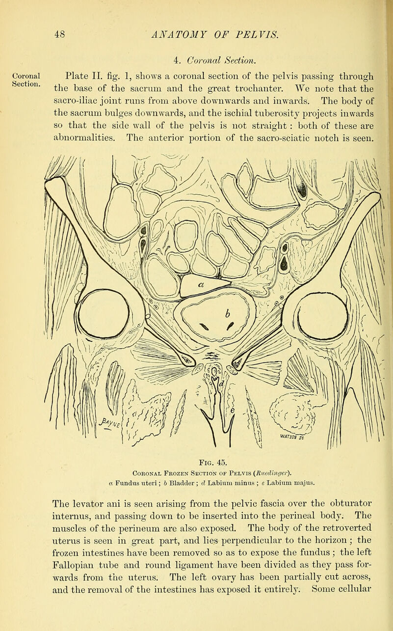 Coronal Section. 4. Coronal Section. Plate II. fig. 1, shows a coronal section of the pelvis passing through the base of the sacrum and the great trochanter. We note that the sacro-iliac joint runs from above downwards and inwards. The body of the sacrum bulges downwards, and the ischial tuberosity projects inwards so that the side wall of the pelvis is not straight: both of these are abnormalities. The anterior portion of the sacro-sciatic notch is seen. Fig. 45. Coronal Frozen Section of Pelvis (Ruedinger). a Fundus uteri ; b Bladder ; d Labium minus ; e Labium majus. The levator ani is seen arising from the pelvic fascia over the obturator internus, and passing down to be inserted into the perineal body. The muscles of the perineum are also exposed. The body of the retroverted uterus is seen in great part, and lies perpendicular to the horizon; the frozen intestines have been removed so as to expose the fundus; the left Fallopian t\ibe and round ligament have been divided as they pass for- wards from the uterus. The left ovary has been partially cut across, and the removal of the intestines has exposed it entirely. Some cellular