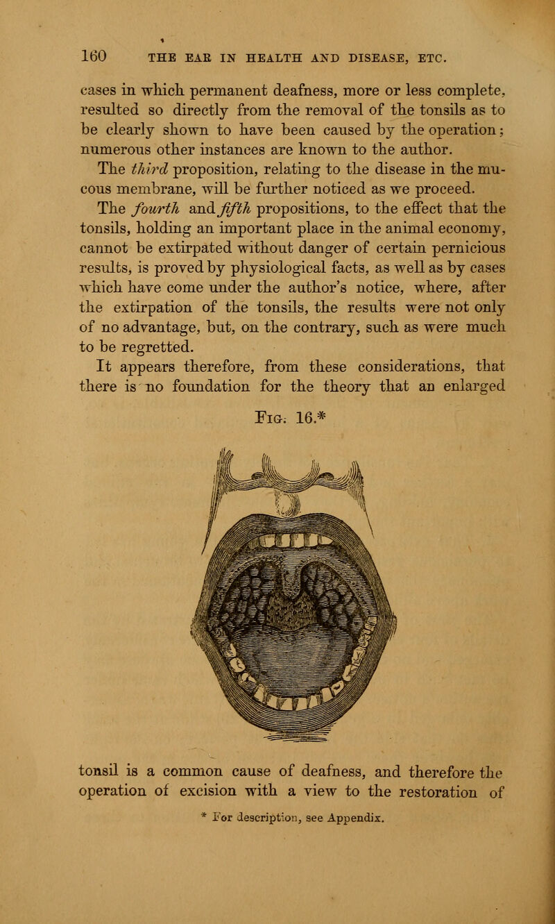 cases in which permanent deafness, more or less complete, resulted so directly from the removal of the tonsils as to be clearly shown to have been caused by the operation; numerous other instances are known to the author. The third proposition, relating to the disease in the mu- cous membrane, will be further noticed as we proceed. The fourth smdjlfth propositions, to the effect that the tonsils, holding an important place in the animal economy, cannot be extirpated without danger of certain pernicious results, is proved by physiological facts, as well as by cases which have come under the author's notice, where, after the extirpation of the tonsils, the results were not only of no advantage, but, on the contrary, such as were much to be regretted. It appears therefore, from these considerations, that there is no foundation for the theory that an enlarged FlG; 16 * .w ILAiisfefl tonsil is a common cause of deafness, and therefore the operation of excision with a view to the restoration of