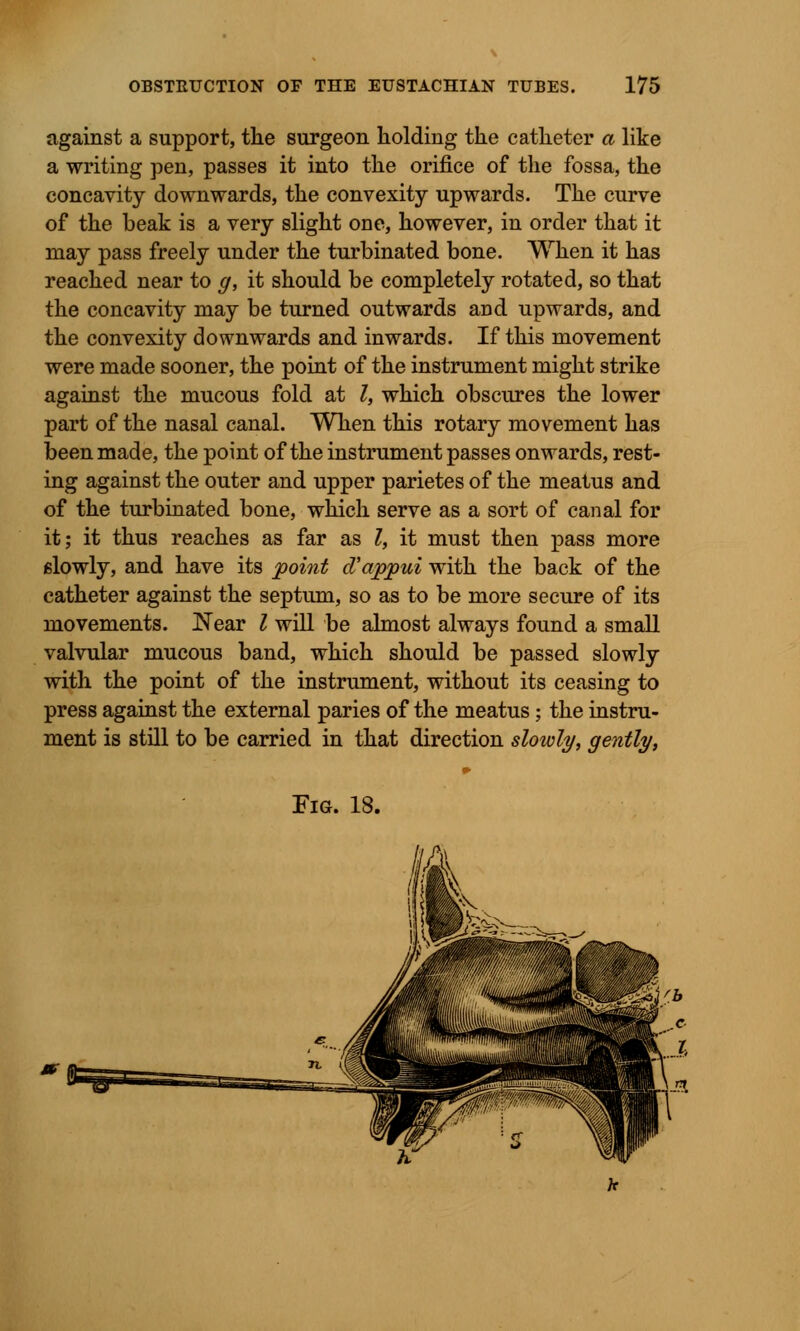 against a support, the surgeon holding the catheter a like a writing pen, passes it into the orifice of the fossa, the concavity downwards, the convexity upwards. The curve of the beak is a very slight one, however, in order that it may pass freely under the turbinated bone. When it has reached near to g, it should be completely rotated, so that the concavity may be turned outwards and upwards, and the convexity downwards and inwards. If this movement were made sooner, the point of the instrument might strike against the mucous fold at I, which obscures the lower part of the nasal canal. When this rotary movement has been made, the point of the instrument passes onwards, rest- ing against the outer and upper parietes of the meatus and of the turbinated bone, which serve as a sort of canal for it; it thus reaches as far as I, it must then pass more slowly, and have its point d'appui with the back of the catheter against the septum, so as to be more secure of its movements. Near I will be almost always found a small valvular mucous band, which should be passed slowly with the point of the instrument, without its ceasing to press against the external paries of the meatus; the instru- ment is still to be carried in that direction slowly, gently, Fig. 18.