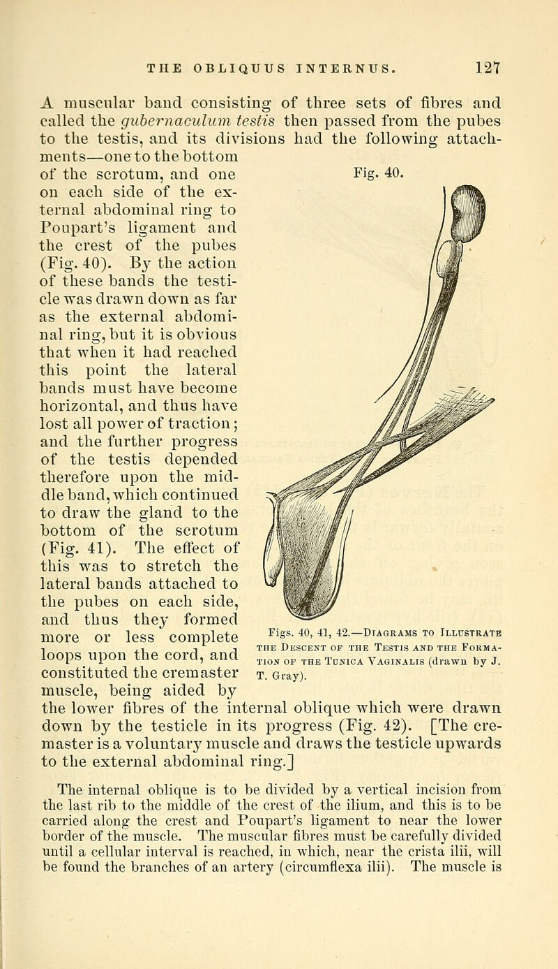 THE OBLIQUUS INTERNUS. 121 A muscular band consisting of three sets of fibres and called the gubernaculum testis then passed from the pubes to the testis, and its divisions had the following attach- ments—one to the bottom of the scrotum, and one on each side of the ex- ternal abdominal ring to Poupart's ligament and the crest of the pubes (Fig. 40). B}^ the action of these bands the testi- cle was drawn down as far as the external abdomi- nal ring, but it is obvious that when it had reached this point the lateral bands must have become horizontal, and thus have lost all power of traction; and the further progress of the testis depended therefore upon the mid- dle band, which continued to draw the gland to the bottom of the scrotum (Fig. 41). The effect of this was to stretch the lateral bands attached to the pubes on each side, and thus they formed more or less complete loops upon the cord, and constituted the cremaster muscle, being aided by the lower fibres of the internal oblique which were drawn down by the testicle in its progress (Fig. 42). [The cre- master is a voluntary muscle and draws the testicle upwards to the external abdominal ring.] The internal oblique is to be divided by a vertical incision from the last rib to the middle of the crest of the ilium, and this is to be carried along the crest and Poupart's ligament to near the lower border of the muscle. The muscular fibres must be carefully divided until a cehular interval is reached, in which, near the crista ilii, will be found the branches of an artery (circumflexa ilii). The muscle is Figs. 40, 41, 42.—Diagrams to Illustrate THE Descent of the Testis and the Forma- tion OP THE Tunica Vaginalis (drawn by J. T. Gray).