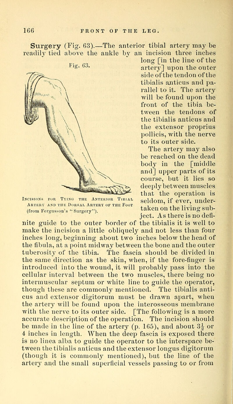 Surgery (Fig- 63).—The anterior tibial artery may be readily tied above the ankle by an incision three inches long [in the line of the ^S ■^' arterj^] upon the outer side of the tendon of the tibialis anticus and pa- rallel to it. The artery will be found upon the front of tlie tibia be- tween the tendons of the tibialis anticus and the extensor proprius pollicis, with the nerve to its outer side. The artery may also be reached on the dead body in the [middle and] upper parts of its course, but it lies so deeply between muscles that the operation is seldom, if ever, under- taken on the living sub- ject. As there is no defi- nite guide to the outer border of the tibialis it is well to make the incision a little obliquel3^ and not less than four inches long, beginning about two inches below the head of the fibula, at a point midway between the bone and the outer tuberosity of the tibia. The fascia should be divided in the same direction as the skin, when, if the fore-finger is introduced into the wound, it will probably pass into the cellular interval between the two muscles, there being no intermuscular septum or white line to guide the operator, though these are commonly mentioned. The tibialis anti- cus and extensor digitorum must be drawn apart, wheu the artery will be found upon the interosseous membrane with tlie nerve to its outer side. [The following is a more accurate description of the operation. The incision should be made in the line of the artery (p. 165), and about 3^ or 4 inches in length. When the deep fascia is exposed there is no linea alba to guide the operator to the interspace be- tween the tibialis anticus and the extensor longus digitorum (though it is commonly mentioned), but the line of the artery and the small superficial vessels passing to or from Incisions for Tying the Anterior Tibial Artery and the Dorsal Artery of the Foot (from Fevgusson's Surgery).