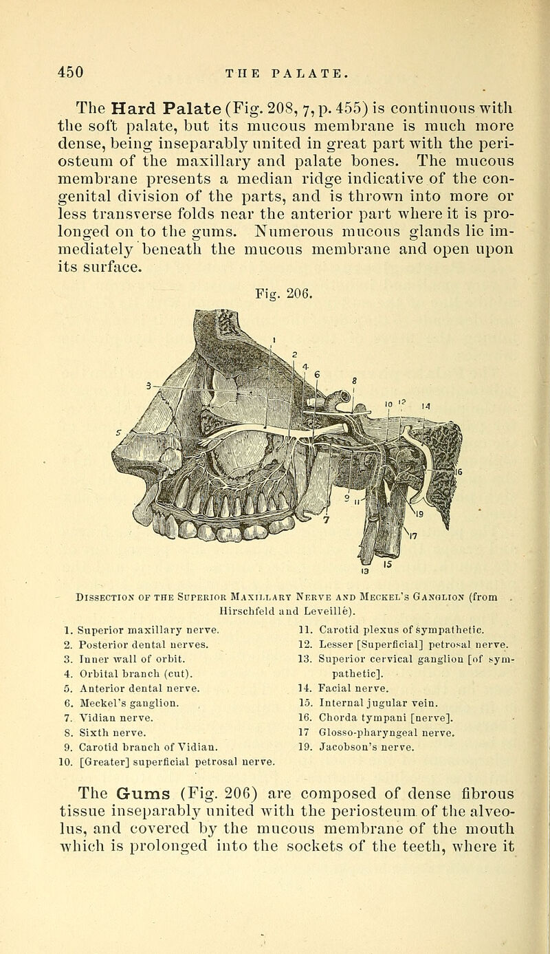 The Hard Palate (Fig. 208, 7, p. 455) is continuous with the soft palate, but its mucous membrane is much more dense, being inseparably united in great part with the peri- osteum of the maxillary and palate bones. The mucous membrane presents a median ridge indicative of the con- genital division of the parts, and is thrown into more or less transverse folds near the anterior part where it is pro- longed on to the gums. Numerous raucous glands lie im- mediately beneath the mucous membrane and open upon its surface. Fig. 206. ' *i' -J '-jTr* '^ ii.1 '^ i Dissection of the Superior Maxilla Hirschfeld 1. Superior maxillary nerve. 2. Posterior dental nerves. 3. Inner wall of orbit. 4. Orbital branch (cut). 5. Anterior dental nerve. 6. Meckel's ganglion. 7. Vidian nerve. S. Sixth nerve. 9. Carotid branch of Vidian. 10. [Greater] superficial petrosal nerve. RY Nerve and Meckel's Ganolion (from and Leveille). 11. Carotid plexus of sympathetic. 12. Lesser [Superficial] petrosal nerve. 13. Superior cervical ganglion [of sym- pathetic]. 14. Facial nerve. 15. Internal jugular vein. 16. Chorda tympani [nerve]. 17 Glosso-pharyngeal nerve. 19. Jacobsou's nerve. The Gums (Fig. 206) are composed of dense fibrous tissue inseparably united with the periosteum, of the alveo- lus, and covered by the mucous membrane of the mouth which is prolonged into the sockets of the teeth, where it