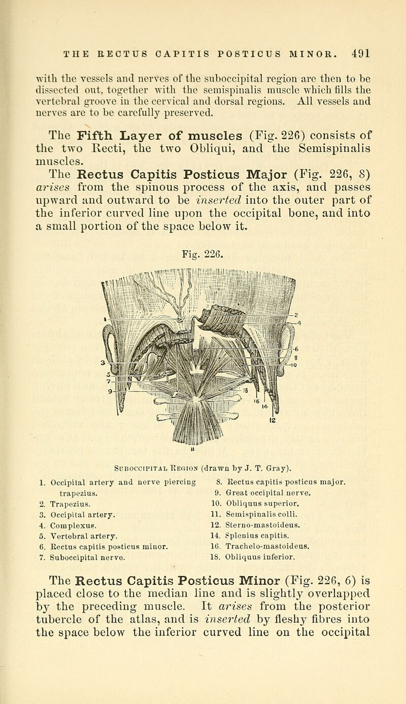 with tlic vessels and nerves of tlie suboccipital region arc then to be dissected out, together with the semispinalis muscle which fills the vertebral groove in the cervical and dorsal regions. All vessels and nerves are to be carefully preserved. The Fifth Layer of muscles (Fig. 226) consists of the two Recti, the two Obliqui, and the Semispinalis muscles. The Rectus Capitis Posticus Major (Fig. 226, 8) arises from the spinous process of the axis, and passes upward and outward to be inserted into the outer part of the inferior curved line upon the occipital bone, and into a small portion of the space below it. Fiff. 226. SnBOCCiPiTAL Region (drawa by J. T. Gray). 1. Occipital artery and nerve piercins trapezius. 2. Trapezius. 3. Occipital artery. 4. Complexus. 5. Vertebral artery. 6. Rectus capitis posticus minor. 7. Suboccipital nerve. 8. Rectus capitis posticus major. 9. Great occipital nerve. 10. Obliquus superior. 11. Semispinalis colli. 12. Sterno-mastoideus. ■ 14. Splenius capitis. 16. Trachelo-mastoideus. 18. Obliquus inferior. The Rectus Capitis Posticus Minor (Fig. 226, 6) is placed close to the median line and is slightly overlapped by the preceding muscle. It arises from the posterior tubercle of the atlas, and is ijiserted by fleshj^ fibres into the space below the inferior curved line on the occipital