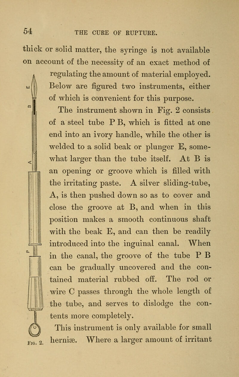 tliick or solid matter, the syringe is not available on account of the necessity of an exact method of regulating the amount of material employed. Below are figured two instruments, either of which is convenient for this purpose. The instrument shown in Fig. 2 consists of a steel tube P B, which is fitted at one end into an ivory handle, while the other is welded to a solid beak or plunger E, some- what larger than the tube itself. At B is an opening or groove which is filled with the irritating paste. A silver sliding-tube, A, is then pushed down so as to cover and close the groove at B, and when in this position makes a smooth continuous shaft with the beak E, and can then be readily introduced into the inguinal canal. When in the canal, the groove of the tube P B can be gradually uncovered and the con- tained material rubbed off. The rod or I wire C passes through the whole length of the tube, and serves to dislodge the con- tents more completely. This instrument is only available for small jj,jg^ 2. herniae. Where a larger amount of irritant