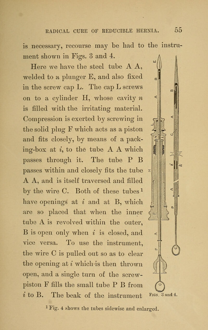 is necessary, recourse may be had to the instru ment shown in Figs. 3 and 4. Here we have the steel tube A A, welded to a plunger E, and also fixed in the screw cap L. The cap L screws on to a cylinder H, whose cavity n is filled with the irritating material. Compression is exerted by screwing in the solid plug F which acts as a piston and fits closely, by means of a pack- ing-box at i, to the tube A A which passes through it. The tube P B passes within and closely fits the tuV)e A A, and is itself traversed and filled by the wire C. Both of these tubes ^ have openings at i and at B, which are so placed that when the inner tube A is revolved within the outer, B is open only when i is closed, and vice versa. To use the instrument, the wire C is pulled out so as to clear the opening at i which-is then thrown open, and a single turn of the screw- piston F fills the small tube P B from f'^ i to B. The beak of the instrument ^^«s- 3and4. 1 Fig. 4 shows the tubes sidewise and enlarged.