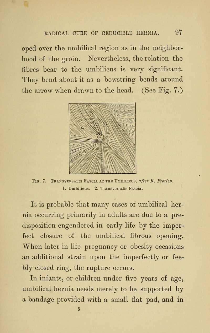 oped over the umbilical region as in the neighbor- hood of the groin. Nevertheless, the relation the fibres bear to the umbilicus is very significant. They bend about it as a bowstring bends around the arrow when drawn to the head. (See Fig. 7.) - — -=-E ,^; / \ ,/ ,///// ' // '// -I'lll w \\\\.\ \ Fig. 7. Transversalis Fascia at the Umbilicus, after R. Froriep. 1. Umbilicus. 2. Transversalis Fascia. It is probable that many cases of umbilical her- nia occurring primarily in adults are due to a pre- disposition engendered in early life by the imper- fect closure of the umbilical fibrous opening. When later in life pregnancy or obesity occasions an additional strain upon the imperfectly or fee- bly closed ring, the rupture occurs. In infants, or children under five years of age, umbilical hernia needs merely to be supported by a bandage provided with a small flat pad, and in
