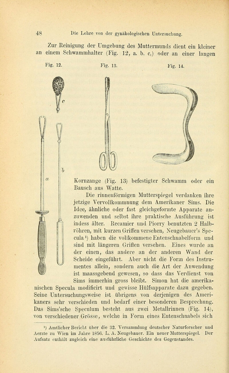 Zur Reinigung der Umgebung des Muttermunds dient ein kleiner an einem Scliwammhalter (Fig. 12, a. b. c,) oder an einer langen Fig. 12. Fig. 13. Fig. 14. 1) Kornzange (Fig. 13) befestigter Schwamm oder ein Bausch aus Watte. Die rinnenförmigen Mutterspiegel verdanken ihre jetzige Vervollkommnung dem Amerikaner Sims. Die Idee, ähnliche oder fast gleichgeformte Apparate an- zuwenden und selbst ihre praktische Ausführung ist /f^ indess älter. Recaraier und Piorry benutzten 2 Halb- I röhren, mit kurzen Griffen versehen, Neugebauer's Spe- cula^) haben die vollkommene Entenschnabelform und sind mit längeren Griffen versehen. Eines wurde an der einen, das andere an der anderen Wand der Scheide eingeführt. Aber nicht die Form des Instru- mentes allein, sondern auch die Art der Anwendung W ist maassgebend gewesen, so dass das Verdienst von Sims immerhin gross bleibt. Simon hat die amerika- nischen Specula modificirt und gewisse Hülfsapparate dazu gegeben. Seine Untersuchungsweise ist übrigens von derjenigen des Ameri- kaners sehr verschieden und bedarf einer besonderen Besprechung. Das Sims'sche Speculum besteht aus zwei Metallrinnen (Fig. 14), von verschiedener Grösse, welche in Form eines Entenschnabels sich 1) Amtlicher Bericht über die 32. Versammlung deutscher Naturforscher und Aerzte zu Wien im Jahre 1856. L. A. Neugebauer. Ein neuer Mutterspiegel. Der Aufsatz enthält zugleich eine ausführliche Geschichte des Gegenstandes.
