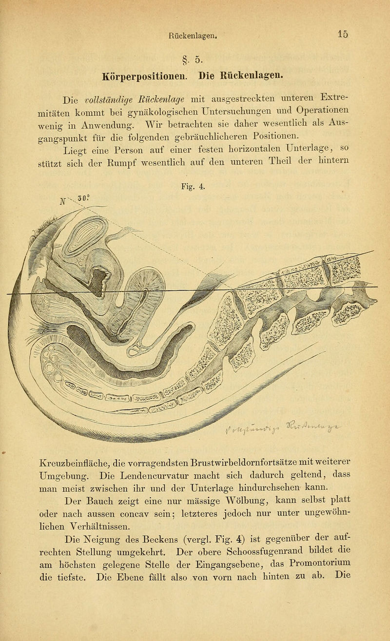 Rückenlagen, §• 5. Körperpositioneii. Die Rückenlagen. Die vollständige Rückenlage mit ausgestreckten unteren Extre- mitäten kommt bei gynäkologischen Untersuchungen und Operationen wenig in Anwendung. Wir betrachten sie daher wesentlich als Aus- gangspunkt für die folgenden gebräuchlicheren Positionen. Liegt eine Person auf einer festen horizontalen Unterlage, so stützt sich der Rumpf wesentlich auf den unteren Theil der hintern Fig. 4. j^55 i/l v Uy »*~?i]f Kreuzbeinfläche, die vorragendsten Brustwirbeldornfortsätze mit weiterer Umgebung. Die Lendencurvatur macht sich dadurch geltend, dass man meist zwischen ihr und der Unterlage hindurchsehen kann. Der Bauch zeigt eine nur massige Wölbung, kann selbst platt oder nach aussen concav sein; letzteres jedoch nur unter ungewöhn- lichen Verhältnissen. Die Neigung des Beckens (vergl. Fig. 4) ist gegenüber der auf- rechten Stellung umgekehrt. Der obere Schoossfugenrand bildet die am höchsten gelegene Stelle der Eingangsebene, das Promontorium die tiefste. Die Ebene fällt also von vorn nach hinten zu ab. Die