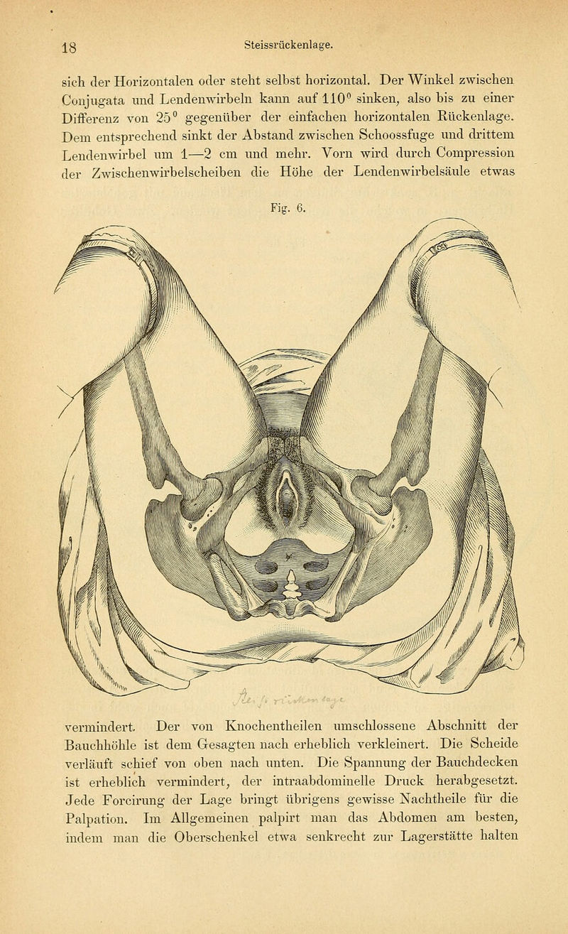 sich der Horizontalen oder steht selbst horizontal. Der Winkel zwischen Conjugata und Lendenwirbeln kann auf 110° sinken, also bis zu einer Differenz von 25° gegenüber der einfachen horizontalen Rückenlage. Dem entsprechend sinkt der Abstand zwischen Schoossfuge und drittem Lendenwirbel um 1—2 cm und mehr. Vorn wird durch Compression der Zwischenwirbelscheiben die Höhe der Lendenwirbelsäule etwas Fig. 6. vermindert. Der von Knochentheilen umschlossene Abschnitt der Bauchhöhle ist dem Gesagten nach erheblich verkleinert. Die Scheide verläuft schief von oben nach unten. Die Spannung der Bauchdecken ist erheblich vermindert, der intraabdominelle Druck herabgesetzt. Jede Forcirung der Lage bringt übrigens gewisse Nachtheile für die Palpation. Im Allgemeinen palpirt man das Abdomen am besten, indem man die Oberschenkel etwa senkrecht zur Lagerstätte halten