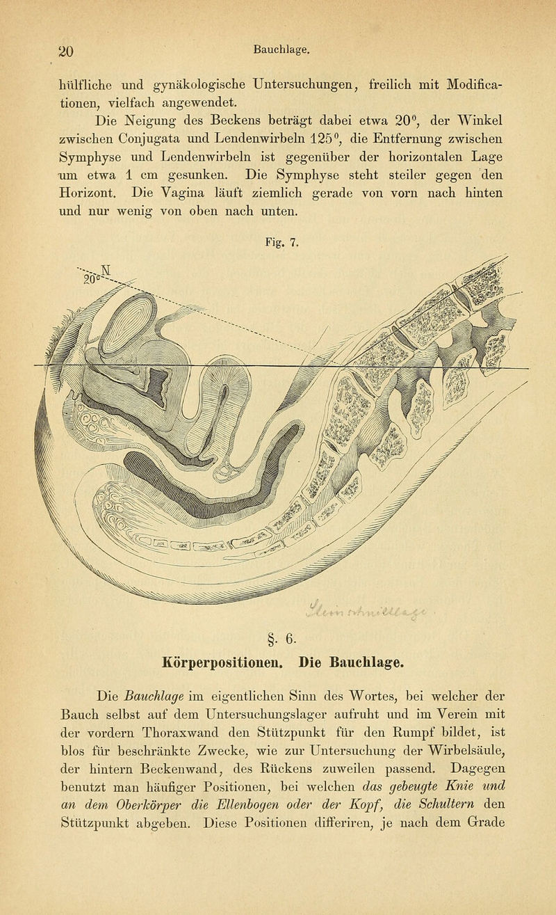 hülfliche und gynäkologische Untersuchungen, freilich mit Modifika- tionen, vielfach angewendet. Die Neigung des Beckens beträgt dabei etwa 20°, der Winkel zwischen Conjugata und Lendenwirbeln 125 °, die Entfernung zwischen Symphyse und Lendenwirbeln ist gegenüber der horizontalen Lage um etwa 1 cm gesunken. Die Symphyse steht steiler gegen den Horizont. Die Vagina läuft ziemlich gerade von vorn nach hinten und nur wenig von oben nach unten. Fig. 7 20°---., §. 6. Körperpositionen. Die Bauchlage. Die Bauchlage im eigentlichen Sinn des Wortes, bei welcher der Bauch selbst auf dem Untersuchungslager aufruht und im Verein mit der vordem Thoraxwand den Stützpunkt für den Rumpf bildet, ist blos für beschränkte Zwecke, wie zur Untersuchung der Wirbelsäule, der hintern Beckenwand, des Rückens zuweilen passend. Dagegen benutzt man häufiger Positionen, bei welchen das gebeugte Knie und an dem Oberkörper die Ellenbogen oder der Kopf, die Schultern den Stützpunkt abgeben. Diese Positionen differiren, je nach dem Grade