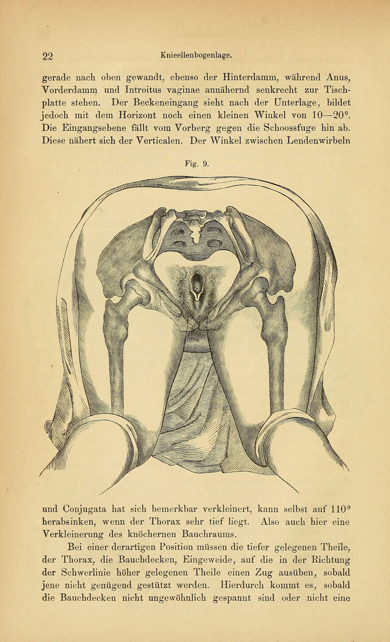 gerade nach oben gewandt, ebenso der Hinterdamm, während Anus, Vorderdamm und Introitus vaginae annähernd senkrecht zur Tisch- platte stehen. Der Beckeneingang sieht nach der Unterlage, bildet jedoch mit dem Horizont noch einen kleinen Winkel von 10—20°. Die Eingangsebene fällt vom Vorberg gegen die Schoossfuge hin ab. Diese nähert sich der Verticalen. Der Winkel zwischen Lendenwirbeln Fig. 9. und Conjugata hat sich bemerkbar verkleinert, kann selbst auf 110° herabsinken, wenn der Thorax sehr tief liegt. Also auch hier eine Verkleinerung des knöchernen Bauchraums. Bei einer derartigen Position müssen die tiefer gelegenen Theile, der Thorax, die Bauchdecken, Eingeweide, auf die in der Richtung der Schwerlinie höher gelegenen Theile einen Zug ausüben, sobald jene nicht genügend gestützt werden. Hierdurch kommt es, sobald die Bauchdecken nicht ungewöhnlich gespannt sind oder nicht eine