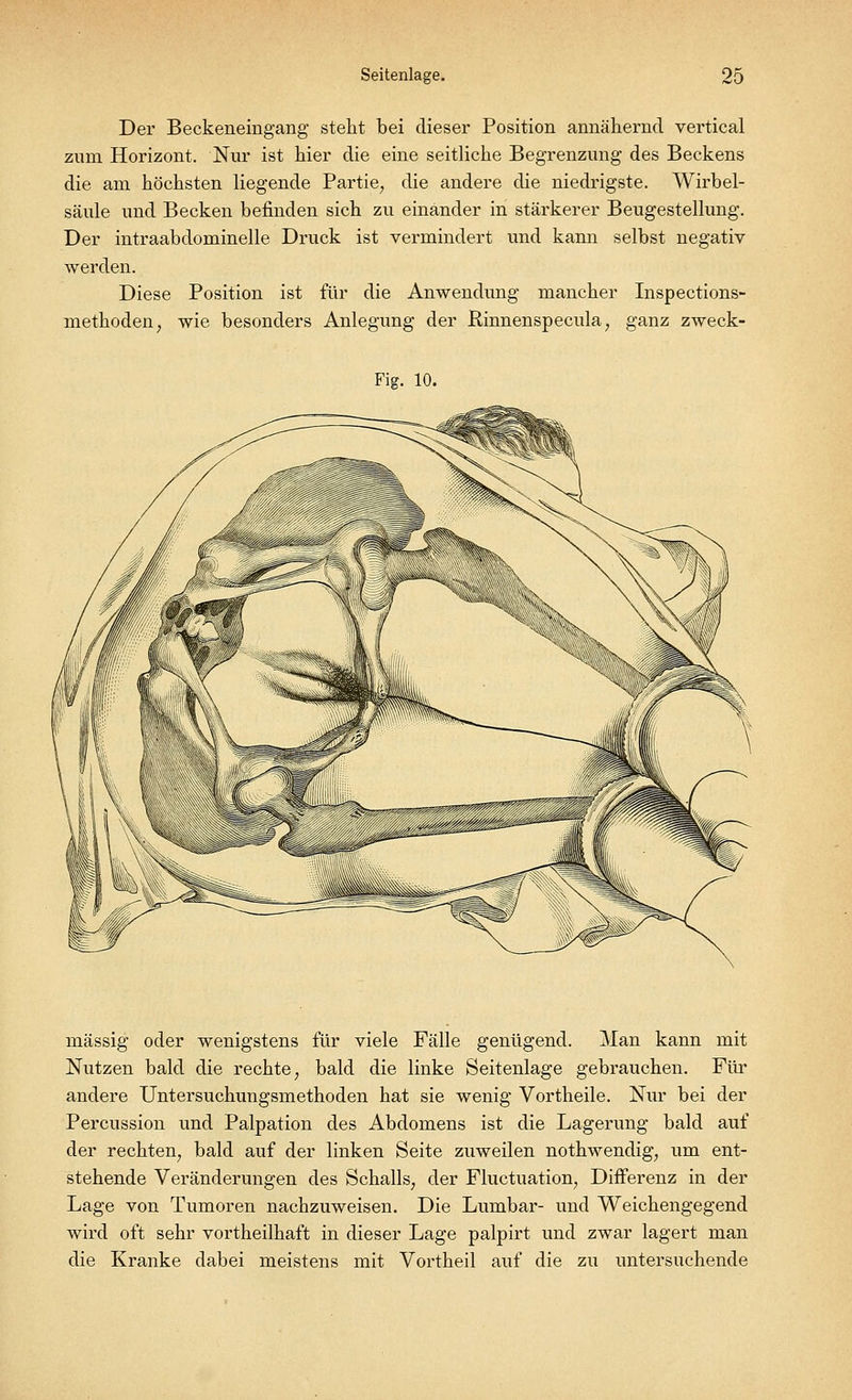Der Beckeneingang stellt bei dieser Position annähernd vertical zum Horizont. Nur ist hier die eine seitliche Begrenzung des Beckens die am höchsten liegende Partie, die andere die niedrigste. Wirbel- säule und Becken befinden sich zu einander in stärkerer Beugestellung. Der intraabdominelle Druck ist vermindert und kann selbst negativ werden. Diese Position ist für die Anwendung mancher Inspections- methoden, wie besonders Anlegung der Rinnenspecula, ganz zweck- Fig. 10. massig oder wenigstens für viele Fälle genügend. Man kann mit Nutzen bald die rechte; bald die linke Seitenlage gebrauchen. Für andere Untersuchungsmethoden hat sie wenig Vortheile. Nur bei der Percussion und Palpation des Abdomens ist die Lagerung bald auf der rechten, bald auf der linken Seite zuweilen nothwendig, um ent- stehende Veränderungen des Schalls, der Fluctuation, Differenz in der Lage von Tumoren nachzuweisen. Die Lumbar- und Weichengegend wird oft sehr vortheilhaft in dieser Lage palpirt und zwar lagert man die Kranke dabei meistens mit Vortheil auf die zu untersuchende