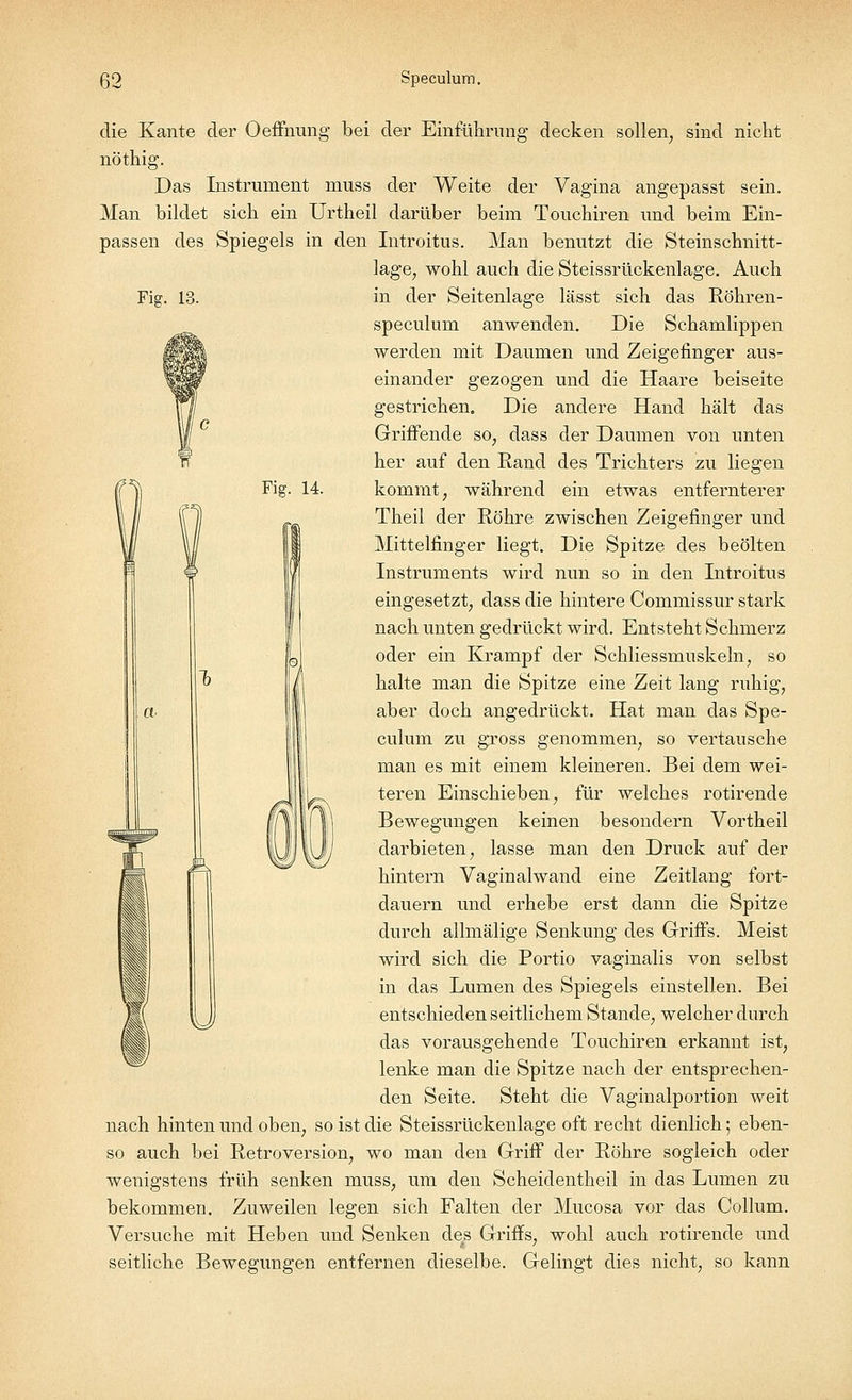 die Kante der Oeffnung bei der Einführung decken sollen, sind nicht nöthig. Das Instrument muss der Weite der Vagina angepasst sein. Man bildet sich ein Urtheil darüber beim Touchiren und beim Ein- passen des Spiegels in den Introitus. Man benutzt die Steinschnitt- lage, wohl auch die Steissrückenlage. Auch Fig. 13. in der Seitenlage lässt sich das Röhren- speculum anwenden. Die Schamlippen werden mit Daumen und Zeigefinger aus- einander gezogen und die Haare beiseite gestrichen. Die andere Hand hält das Griffende so, dass der Daumen von unten her auf den Rand des Trichters zu liegen Fig. 14. kommt; während ein etwas entfernterer Theil der Röhre zwischen Zeigefinger und Mittelfinger liegt. Die Spitze des beölten Instruments wird nun so in den Introitus eingesetzt, dass die hintere Commissur stark nach unten gedrückt wird. Entsteht Schmerz oder ein Krampf der Schliessmuskeln, so halte man die Spitze eine Zeit lang ruhig, aber doch angedrückt. Hat man das Spe- culum zu gross genommen, so vertausche man es mit einem kleineren. Bei dem wei- teren Einschieben, für welches rotirende Bewegungen keinen besondern Vortheil darbieten, lasse man den Druck auf der hintern Vaginalwand eine Zeitlang fort- dauern und erhebe erst dann die Spitze durch allmälige Senkung des Griffs. Meist wird sich die Portio vaginalis von selbst in das Lumen des Spiegels einstellen. Bei entschieden seitlichem Stande, welcher durch das vorausgehende Touchiren erkannt ist, lenke man die Spitze nach der entsprechen- den Seite. Steht die Vaginalportion weit nach hinten und oben, so ist die Steissrückenlage oft recht dienlich; eben- so auch bei Retroversion, wo man den Griff der Röhre sogleich oder wenigstens früh senken muss, um den Scheidentheil in das Lumen zu bekommen. Zuweilen legen sich Falten der Mucosa vor das Collum. Versuche mit Heben und Senken de.s Griffs, wohl auch rotirende und seitliche Bewegungen entfernen dieselbe. Gelingt dies nicht, so kann