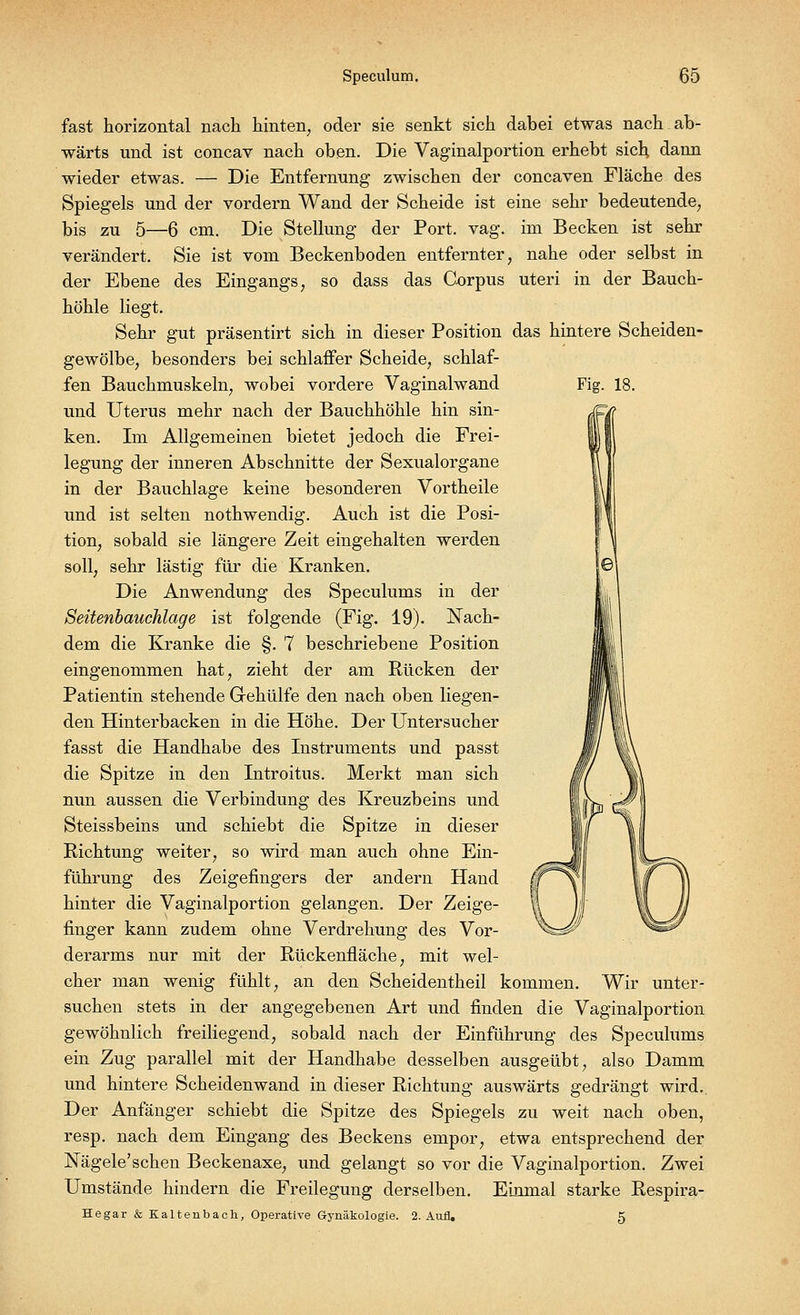 Fig. 18. fast horizontal nach hinten, oder sie senkt sich dabei etwas nach ab- wärts und ist concav nach oben. Die Vaginalportion erhebt sich dann wieder etwas. — Die Entfernung zwischen der concaven Fläche des Spiegels und der vordem Wand der Scheide ist eine sehr bedeutende, bis zu 5—6 cm. Die Stellung der Port. vag. im Becken ist sehr verändert. Sie ist vom Beckenboden entfernter, nahe oder selbst in der Ebene des Eingangs, so dass das Corpus uteri in der Bauch- höhle liegt. Sehr gut präsentirt sich in dieser Position das hintere Scheiden- gewölbe, besonders bei schlaffer Scheide, schlaf- fen Bauchmuskeln, wobei vordere Vaginalwand und Uterus mehr nach der Bauchhöhle hin sin- ken. Im Allgemeinen bietet jedoch die Frei- legung der inneren Abschnitte der Sexualorgane in der Bauchlage keine besonderen Vortheile und ist selten nothwendig. Auch ist die Posi- tion, sobald sie längere Zeit eingehalten werden soll, sehr lästig für die Kranken. Die Anwendung des Speculums in der Seitenbauchlage ist folgende (Fig. 19). Nach- dem die Kranke die §. 7 beschriebene Position eingenommen hat, zieht der am Rücken der Patientin stehende Grehülfe den nach oben liegen- den Hinterbacken in die Höhe. Der Untersucher fasst die Handhabe des Instruments und passt die Spitze in den Introitus. Merkt man sich nun aussen die Verbindung des Kreuzbeins und Steissbeins und schiebt die Spitze in dieser Richtung weiter, so wird man auch ohne Ein- führung des Zeigefingers der andern Hand hinter die Vaginalportion gelangen. Der Zeige- finger kann zudem ohne Verdrehung des Vor- derarms nur mit der Rückenfläche, mit wel- cher man wenig fühlt, an den Scheidentheil kommen. Wir unter- suchen stets in der angegebenen Art und finden die Vaginalportion gewöhnlich freiliegend, sobald nach der Einführung des Speculums ein Zug parallel mit der Handhabe desselben ausgeübt, also Damm und hintere Scheiden wand in dieser Richtung auswärts gedrängt wird. Der Anfänger schiebt die Spitze des Spiegels zu weit nach oben, resp. nach dem Eingang des Beckens empor, etwa entsprechend der Nägele'schen Beckenaxe, und gelangt so vor die Vaginalportion. Zwei Umstände hindern die Freilegung derselben. Einmal starke Respira- Hegar & Kaltenbach, Operative Gynäkologie. 2. Aufl. 5