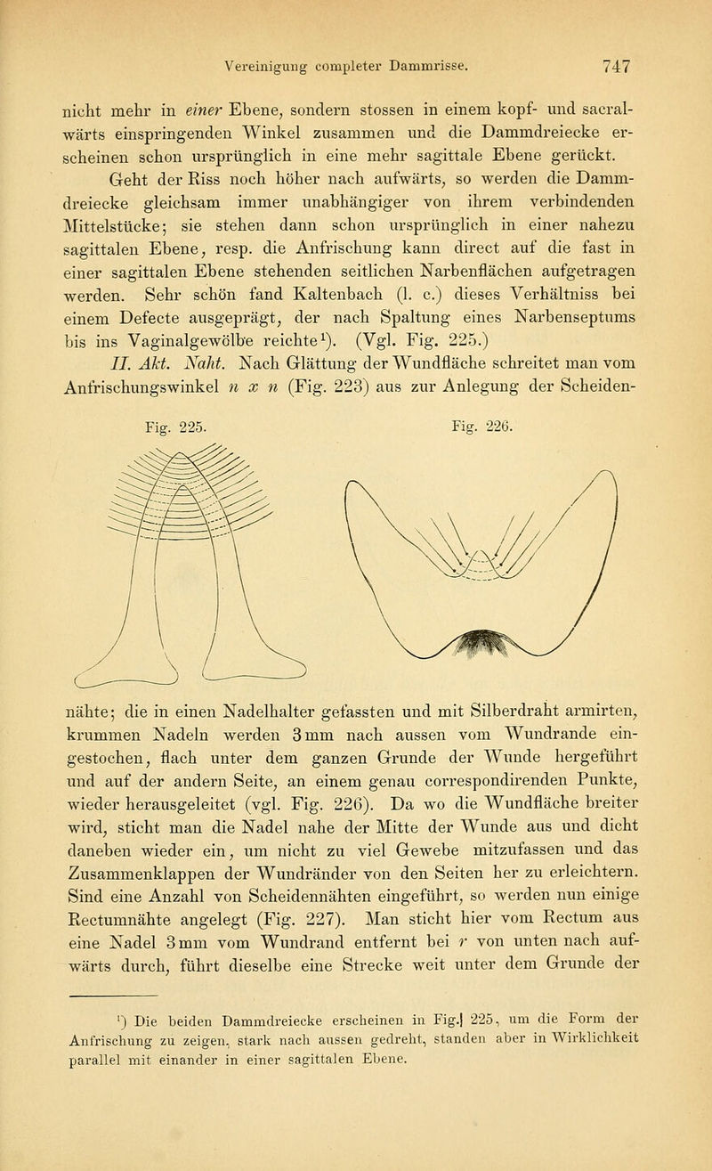 nicht mehr in einer Ebene, sondern stossen in einem köpf- und sacral- wärts einspringenden Winkel zusammen und die Dammdreiecke er- scheinen schon ursprünglich in eine mehr sagittale Ebene gerückt. Geht der Riss noch höher nach aufwärts, so werden die Damm- dreiecke gleichsam immer unabhängiger von ihrem verbindenden Mittelstücke; sie stehen dann schon ursprünglich in einer nahezu sagittalen Ebene, resp. die Anfrischung kann direct auf die fast in einer sagittalen Ebene stehenden seitlichen Narbenflächen aufgetragen werden. Sehr schön fand Kaltenbach (1. c.) dieses Verhältniss bei einem Defecte ausgeprägt, der nach Spaltung eines Narbenseptums bis ins Vaginalgewölbe reichte1). (Vgl. Fig. 225.) II. Akt. Naht. Nach Glättung der Wundfläche schreitet man vom Anfrischungswinkel n x n (Fig. 223) aus zur Anlegung der Scheiden- Fig. 225. Fig. 226. nähte; die in einen Nadelhalter gefassten und mit Silberdraht armirten, krummen Nadeln werden 3 mm nach aussen vom Wundrande ein- gestochen, flach unter dem ganzen Grunde der Wunde hergeführt und auf der andern Seite, an einem genau correspondirenden Punkte, wieder herausgeleitet (vgl. Fig. 226). Da wo die Wundfläche breiter wird, sticht man die Nadel nahe der Mitte der Wunde aus und dicht daneben wieder ein, um nicht zu viel Gewebe mitzufassen und das Zusammenklappen der Wundränder von den Seiten her zu erleichtern. Sind eine Anzahl von Scheidennähten eingeführt, so werden nun einige Rectunmähte angelegt (Fig. 227). Man sticht hier vom Rectum aus eine Nadel 3 mm vom Wundrand entfernt bei r von unten nach auf- wärts durch, führt dieselbe eine Strecke weit unter dem Grunde der !) Die beiden Dammdreiecke erscheinen in Fig.| 225, um die Form der Anfrischung zu zeigen, stark nach aussen gedreht, standen aber in Wirklichkeit parallel mit einander in einer sagittalen Ebene.