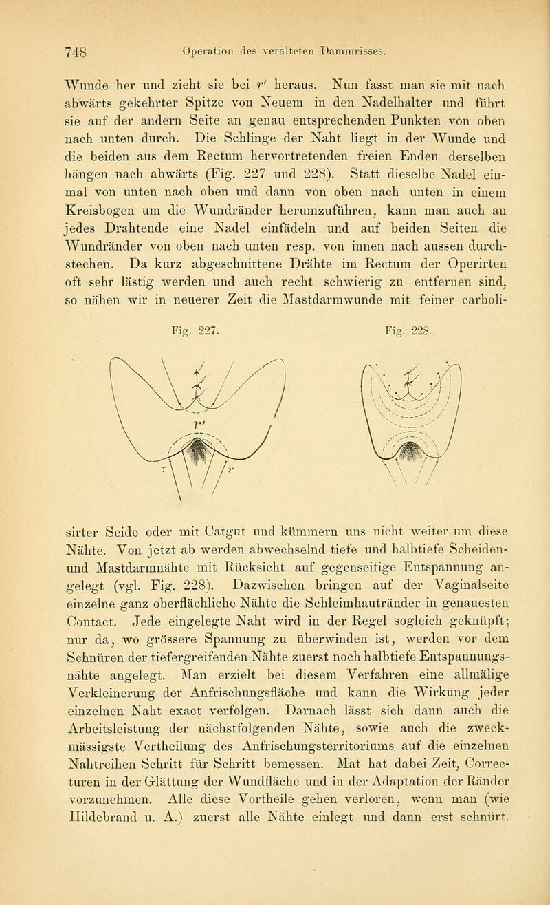 Wunde her und zieht sie bei r' heraus. Nun fasst man sie mit nach abwärts gekehrter Spitze von Neuem in den Nadelhalter und führt sie auf der andern Seite an genau entsprechenden Punkten von oben nach unten durch. Die Schlinge der Naht liegt in der Wunde und die beiden aus dem Rectum hervortretenden freien Enden derselben hängen nach abwärts (Fig. 227 und 228). Statt dieselbe Nadel ein- mal von unten nach oben und dann von oben nach unten in einem Kreisbogen um die Wundränder herumzuführen, kann man auch an jedes Drahtende eine Nadel einfädeln und auf beiden Seiten die Wundränder von oben nach unten resp. von innen nach aussen durch- stechen. Da kurz abgeschnittene Drähte im Rectum der Operirten oft sehr lästig werden und auch recht schwierig zu entfernen sind, so nähen wir in neuerer Zeit die Mastdarmwunde mit feiner carboli- Fia-. 227. Fig. 228. sirter Seide oder mit Catgut und kümmern uns nicht weiter um diese Nähte. Von jetzt ab werden abwechselnd tiefe und halbtiefe Scheiden- und Mastdarmnähte mit Rücksicht auf gegenseitige Entspannung an- gelegt (vgl. Fig. 228). Dazwischen bringen auf der Vaginalseite einzelne ganz oberflächliche Nähte die Schleimhautränder in genauesten Contact. Jede eingelegte Naht wird in der Regel sogleich geknüpft; nur da, wo grössere Spannung zu überwinden ist, werden vor dem Schnüren der tiefergreifenden Nähte zuerst noch halbtiefe Entspannungs- nähte angelegt. Man erzielt bei diesem Verfahren eine allniälige Verkleinerung der Anfrischungsfläche und kann die Wirkung jeder einzelnen Naht exact verfolgen. Darnach lässt sich dann auch die Arbeitsleistung der nächstfolgenden Nähte, sowie auch die zweck- mässigste Vertheilung des Anfrischungsterritoriums auf die einzelnen Nahtreihen Schritt für Schritt bemessen. Mat hat dabei Zeit, Correc- turen in der Glättung der Wundfläche und in der Adaptation der Ränder vorzunehmen. Alle diese Vortheile gehen verloren, wenn man (wie Hildebrand u. A.) zuerst alle Nähte einlegt und dann erst schnürt.