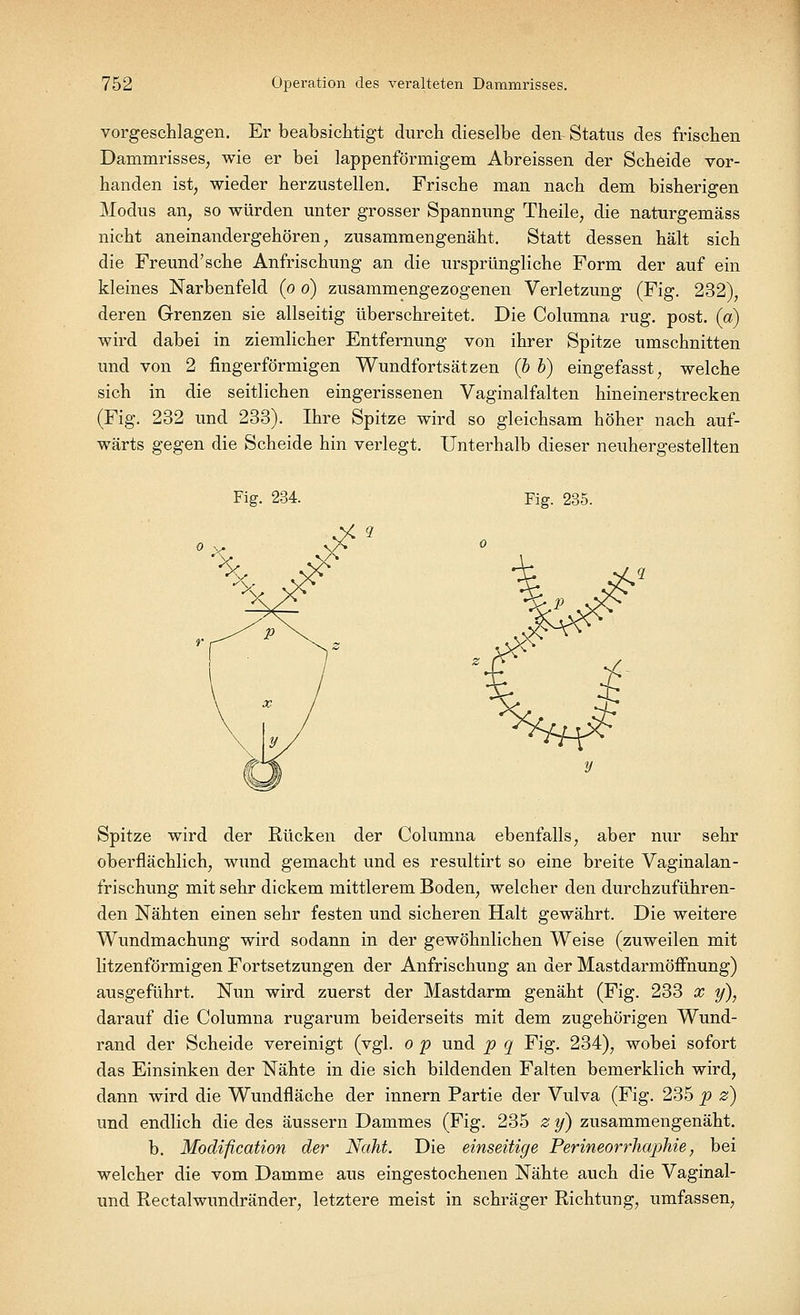 vorgeschlagen. Er beabsichtigt durch dieselbe den Status des frischen Dammrisses;, wie er bei lappenförmigem Abreissen der Scheide vor- handen ist, wieder herzustellen. Frische man nach dem bisherigen Modus an, so würden unter grosser Spannung Theile, die naturgemäss nicht aneinandergehören, zusammengenäht. Statt dessen hält sich die Freund'sehe Anfrischung an die ursprüngliche Form der auf ein kleines Narbenfeld (o d) zusammengezogenen Verletzung (Fig. 232), deren Grenzen sie allseitig überschreitet. Die Columna rüg. post. (a) wird dabei in ziemlicher Entfernung von ihrer Spitze umschnitten und von 2 fingerförmigen Wundfortsätzen (b b) eingefasst, welche sich in die seitlichen eingerissenen Vaginalfalten hineinerstrecken (Fig. 232 und 233). Ihre Spitze wird so gleichsam höher nach auf- wärts gegen die Scheide hin verlegt. Unterhalb dieser neuhergestellten Fig. 234. Fig. 235. •&.* ** # Spitze wird der Rücken der Columna ebenfalls, aber nur sehr oberflächlich, wund gemacht und es resultirt so eine breite Vaginalan- frischung mit sehr dickem mittlerem Boden, welcher den durchzuführen- den Nähten einen sehr festen und sicheren Halt gewährt. Die weitere Wundmachung wird sodann in der gewöhnlichen Weise (zuweilen mit litzenförmigen Fortsetzungen der Anfrischung an der Mastdarmöffnung) ausgeführt. Nun wird zuerst der Mastdarm genäht (Fig. 233 x y), darauf die Columna rugarum beiderseits mit dem zugehörigen Wund- rand der Scheide vereinigt (vgl. o p und p q Fig. 234), wobei sofort das Einsinken der Nähte in die sich bildenden Falten bemerklich wird, dann wird die Wundfläche der innern Partie der Vulva (Fig. 235 p z) und endlich die des äussern Dammes (Fig. 235 z y) zusammengenäht. b. Modification der Naht. Die einseitige Perineorrhaphie, bei welcher die vom Damme aus eingestochenen Nähte auch die Vaginal- und Rectalwundränder, letztere meist in schräger Richtung, umfassen,