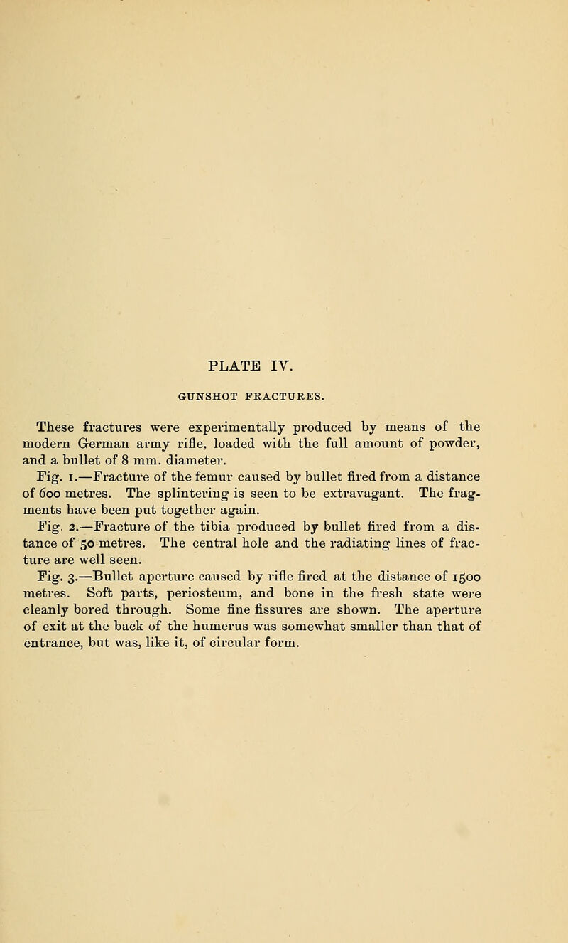 GUNSHOT FRACTURES. These fractures were experimentally produced by means of tlie modern German army rifle, loaded with the full amount of powder, and a bullet of 8 mm. diameter. Fig. I.—Fracture of the femur caused by bullet fired from a distance of 600 metres. The splintering is seen to be extravagant. The frag- ments have been put together again. Fig. 2.—Fracture of the tibia produced by bullet fired from a dis- tance of 50 metres. The central hole and the radiating lines of frac- ture are well seen. Fig. 3.—Bullet aperture caused by rifle fired at the distance of 1500 metres. Soft parts, periosteum, and bone in the fresh state were cleanly bored through. Some fine fissures are shown. The aperture of exit at the back of the humerus was somewhat smaller than that of entrance, but was, like it, of circular form.