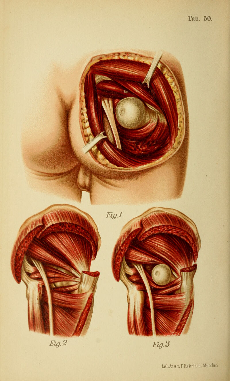 Fig.2 Fig.3 LithJtast.v. F. ReichhoM, Miiiubfn