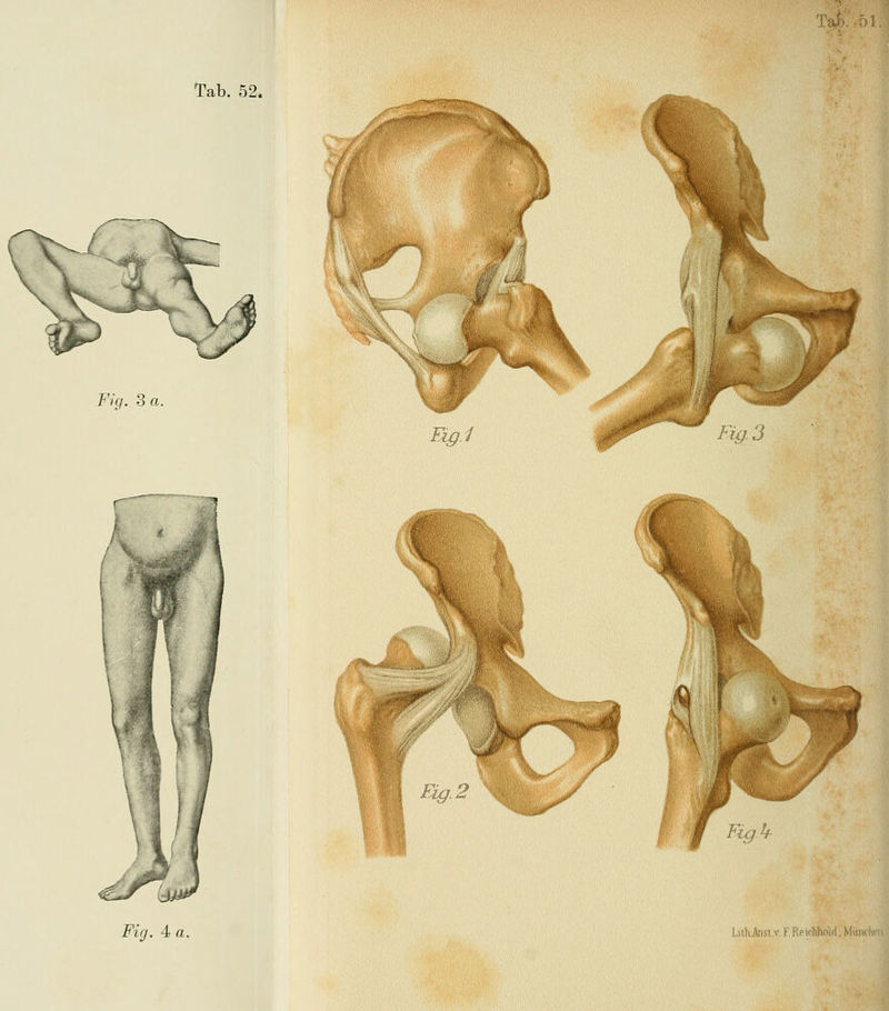 Tafc/.ol Tab. 52. Fk/. 3 a. Ei^.1 Fig. 3 % I I %^